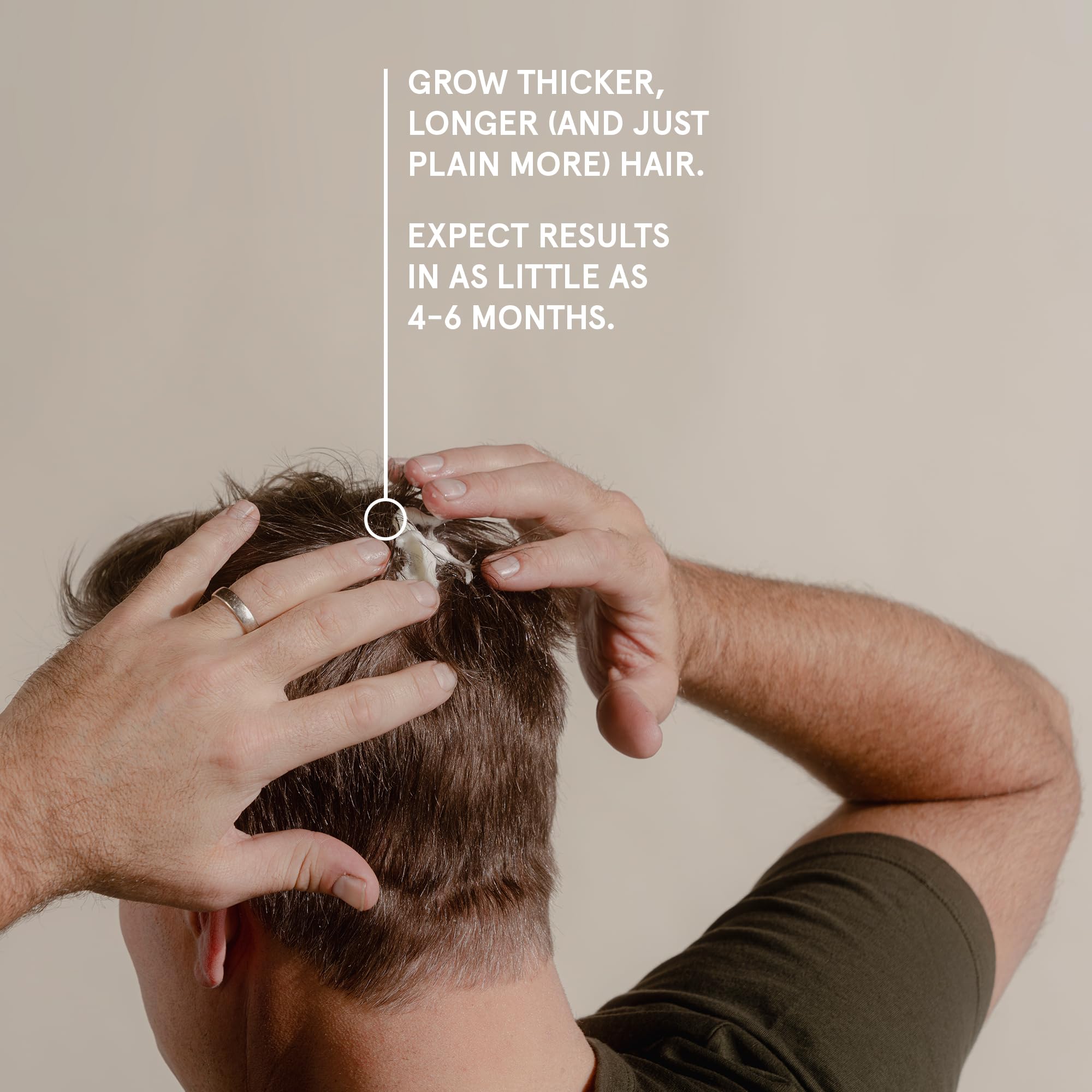Foto 8 pulgar | El Tratamiento Para El Crecimiento Del Cabello Mantiene Una Fuerza Extra Con Minoxidil 5% En Hombres - Venta Internac