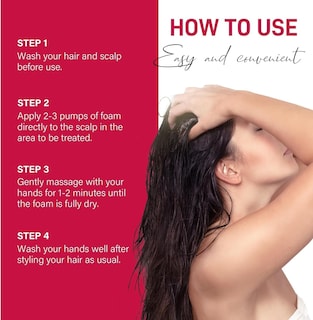 Foto 4 | Tratamiento Para El Crecimiento Del Cabello Yzmoffer Minoxidil Con 5% De Espuma, 62 Ml, Paquete De 2 - Venta Internac