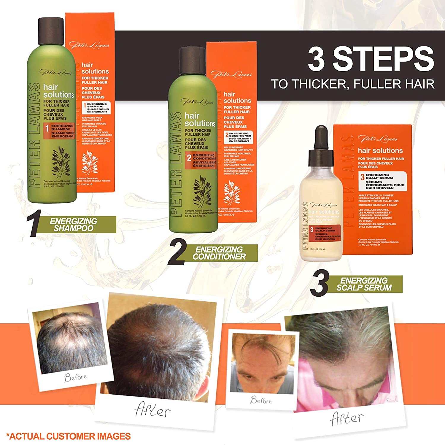Foto 7 | Sérum Para Cuero Cabelludo Peter Lamas Hair Solutions, Energizante, 50 Ml - Venta Internacional.