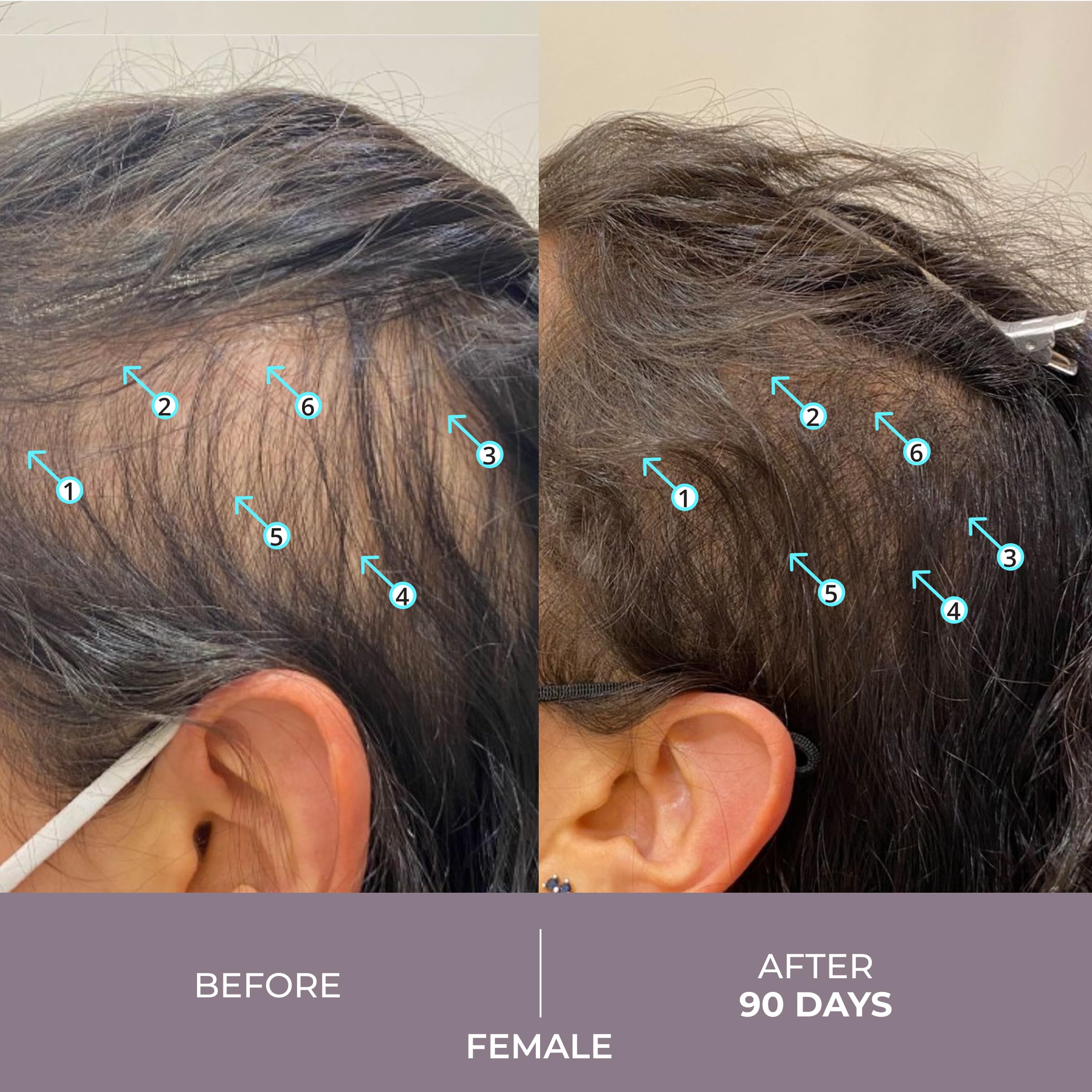 Foto 4 | Sérum Capilar Ds Laboratories Spectral.csf Biotin Women - Venta Internacional.