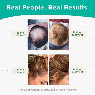 Foto 5 | Acondicionador Anticaída Shapiro Md Dht Para Combatir La Caída Del Cabello, Suministro De 2 Meses - Venta Internaciona