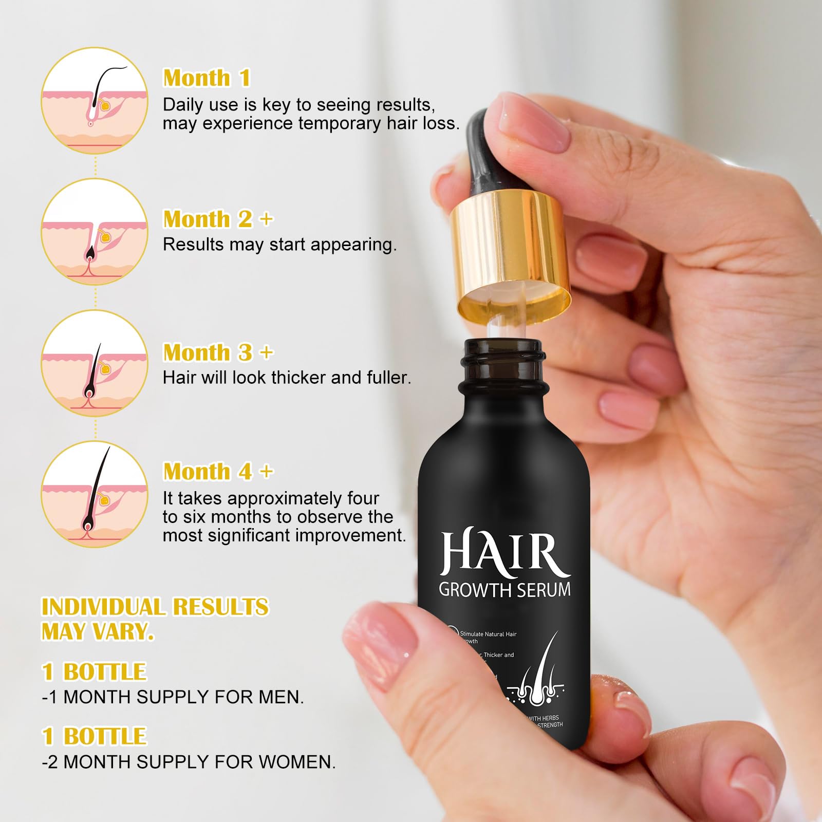 Foto 5 | Kit Para El Crecimiento Del Cabello Y Aceite Derma Roller Para El Crecimiento Del Cabello, 0,25 Mm, 60 Ml - Vent