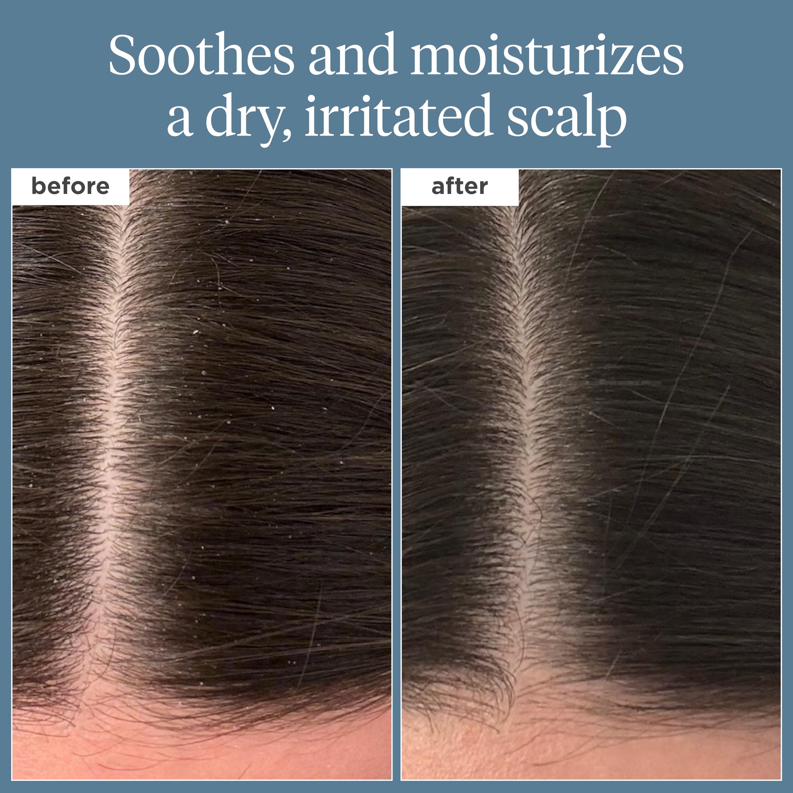 Foto 2 | Aceite De Prelavado Scalp Revival Rosemary Briogeo, 100 Ml, Vegano - Venta Internacional.