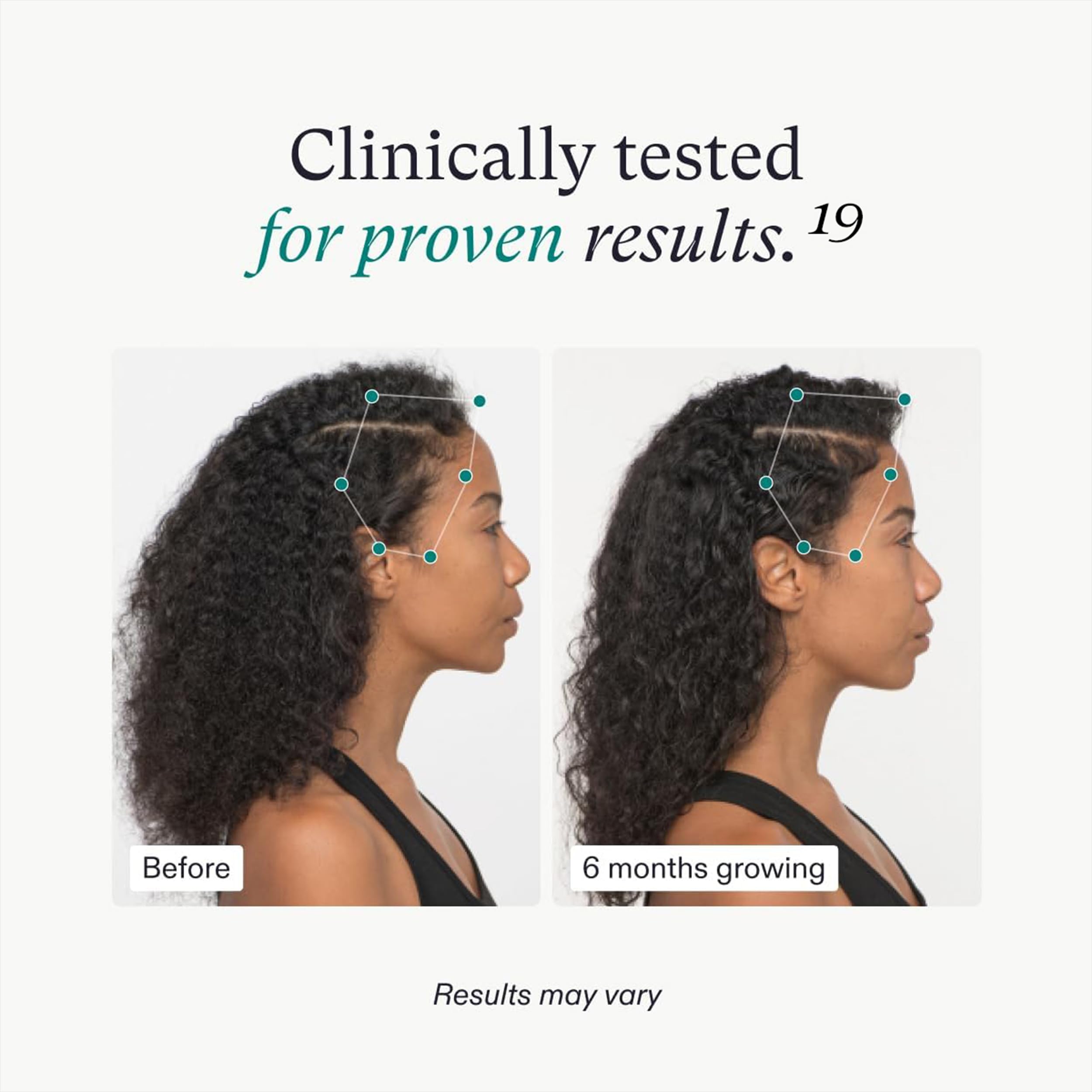 Foto 5 pulgar | Suplementos Para El Crecimiento Del Cabello Nutrafol, Suministro De 2 Meses Para Mujeres - Venta Internacional.