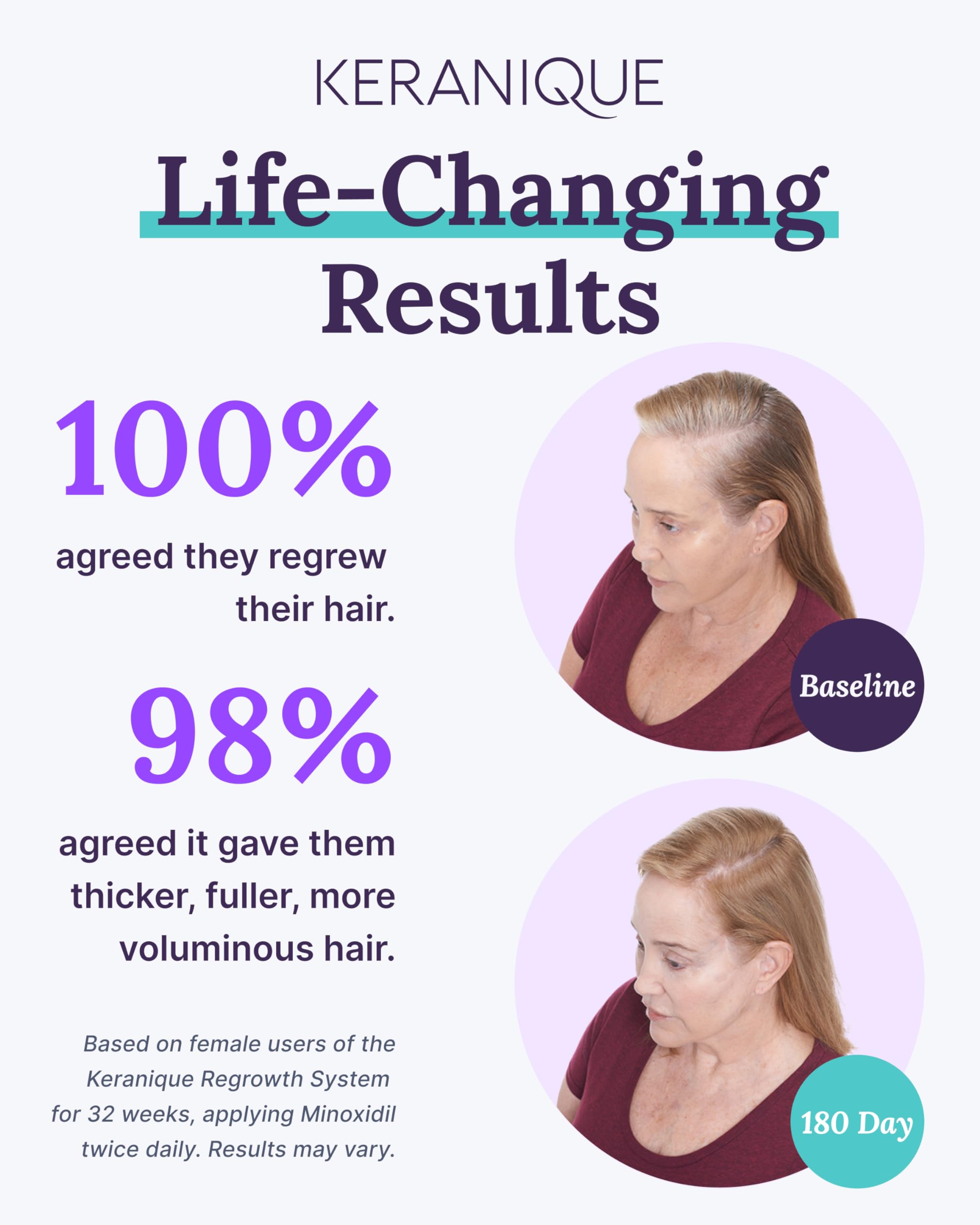 Foto 4 pulgar | Set Keranique Para El Crecimiento Del Cabello Con 2% De Minoxidil Para Mujer Con Champú - Venta Internacional.