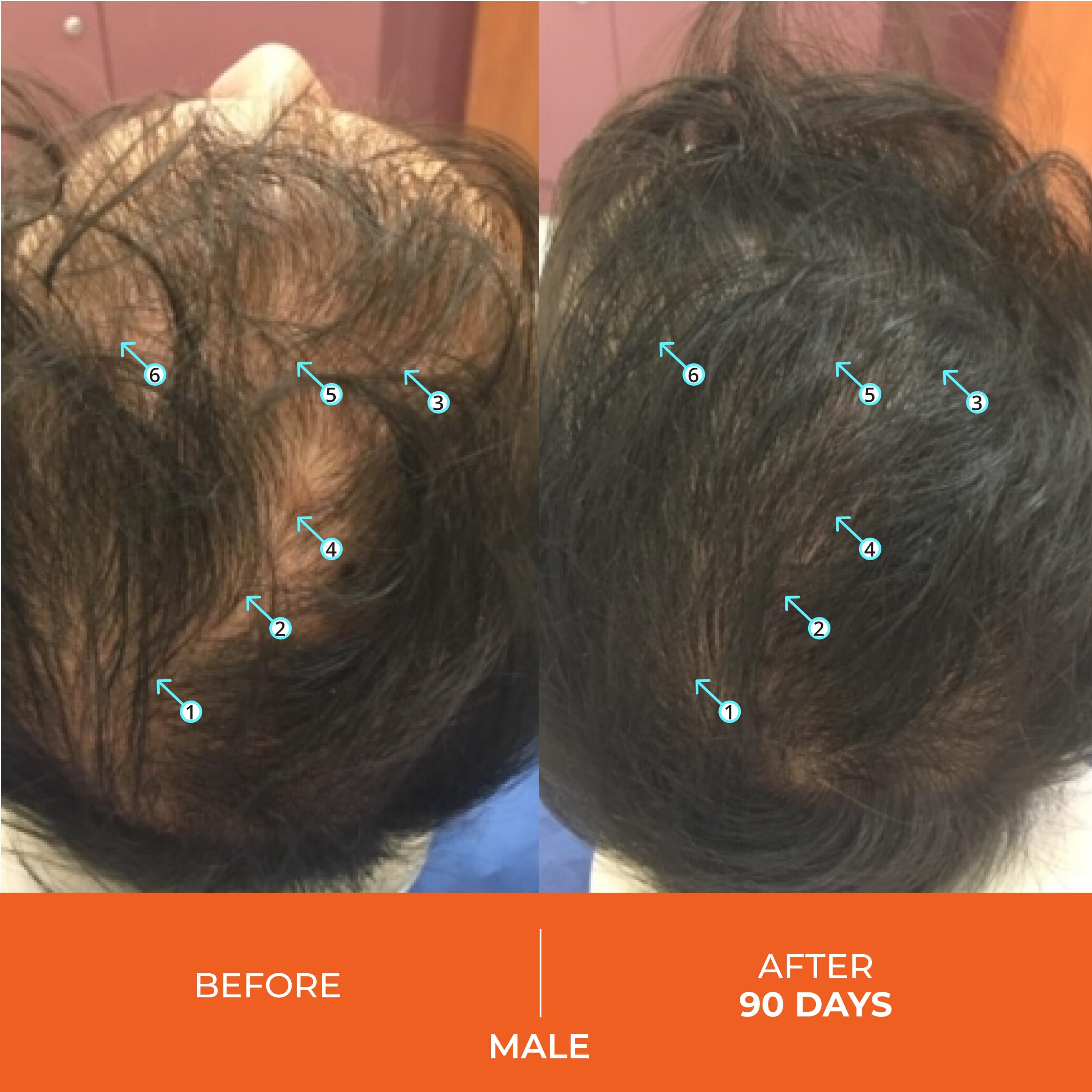 Foto 4 pulgar | Tabletas Para El Crecimiento Del Cabello Ds Laboratories Revita Para Mujeres Y Hombres - Venta Internacional.