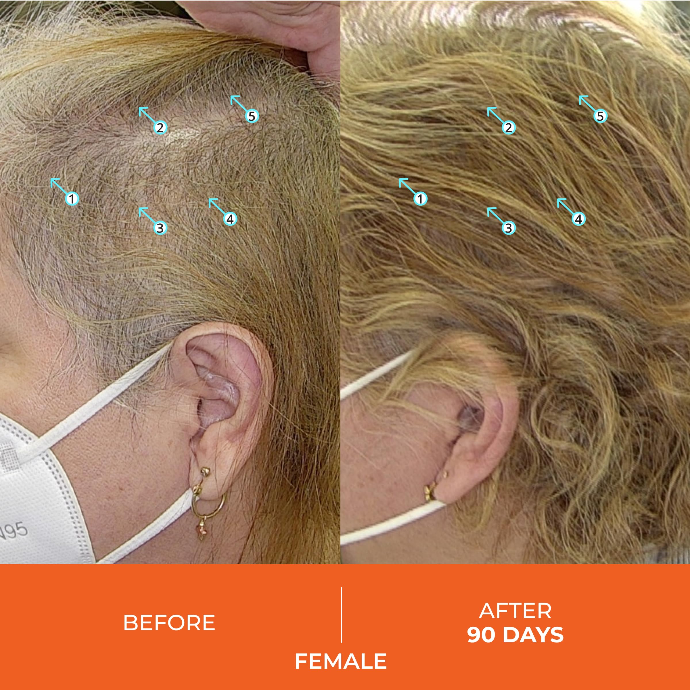 Foto 5 pulgar | Tabletas Para El Crecimiento Del Cabello Ds Laboratories Revita Para Mujeres Y Hombres - Venta Internacional.