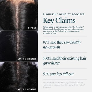 Foto 6 | Tratamiento En Aerosol Para Adelgazar La Densidad Del Cabello Virtue - Venta Internacional.