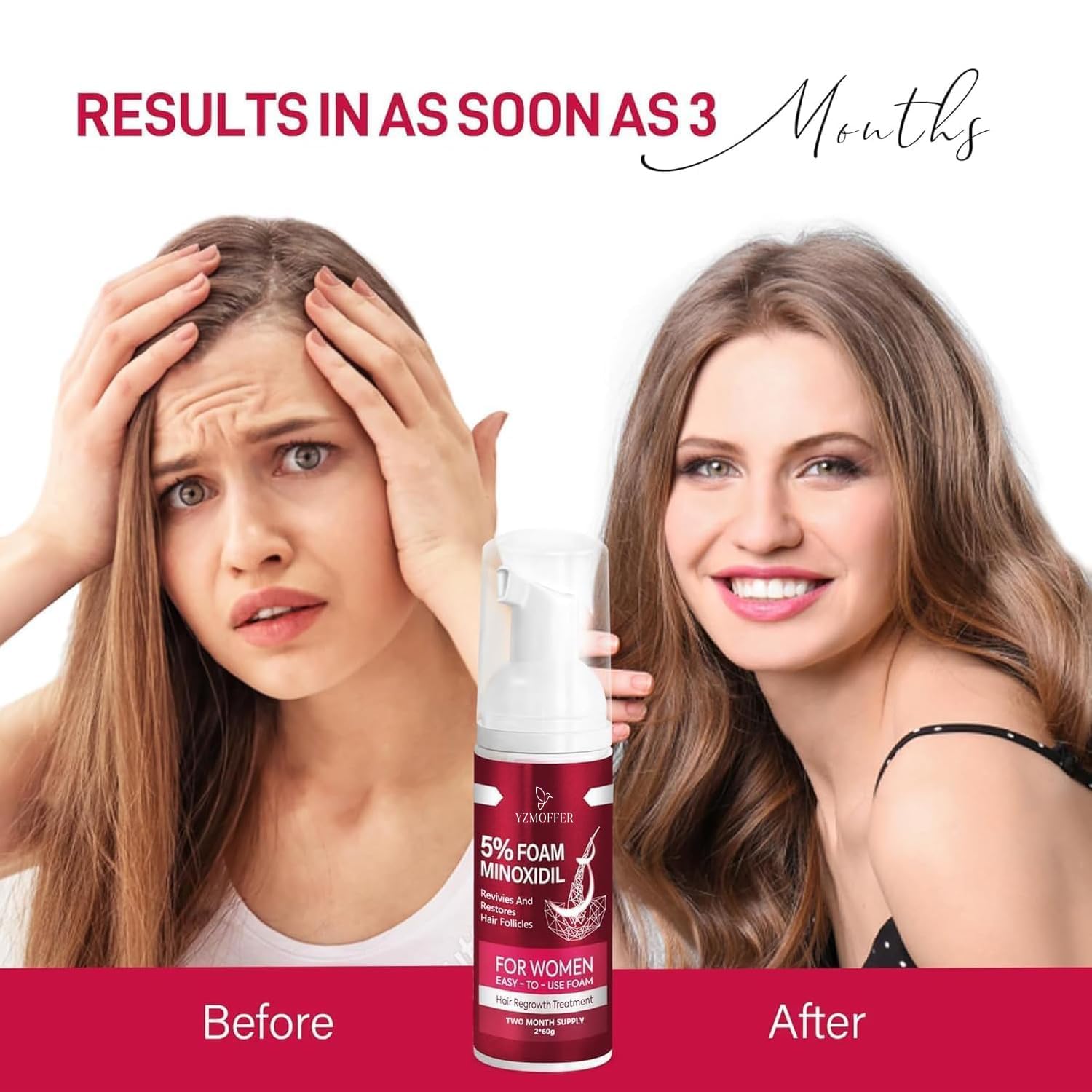 Foto 7 pulgar | Espuma De Minoxidil Para El Crecimiento Del Cabello Femenino Al 5%, 60 Ml, Paquete De 2 - Venta Internacional.