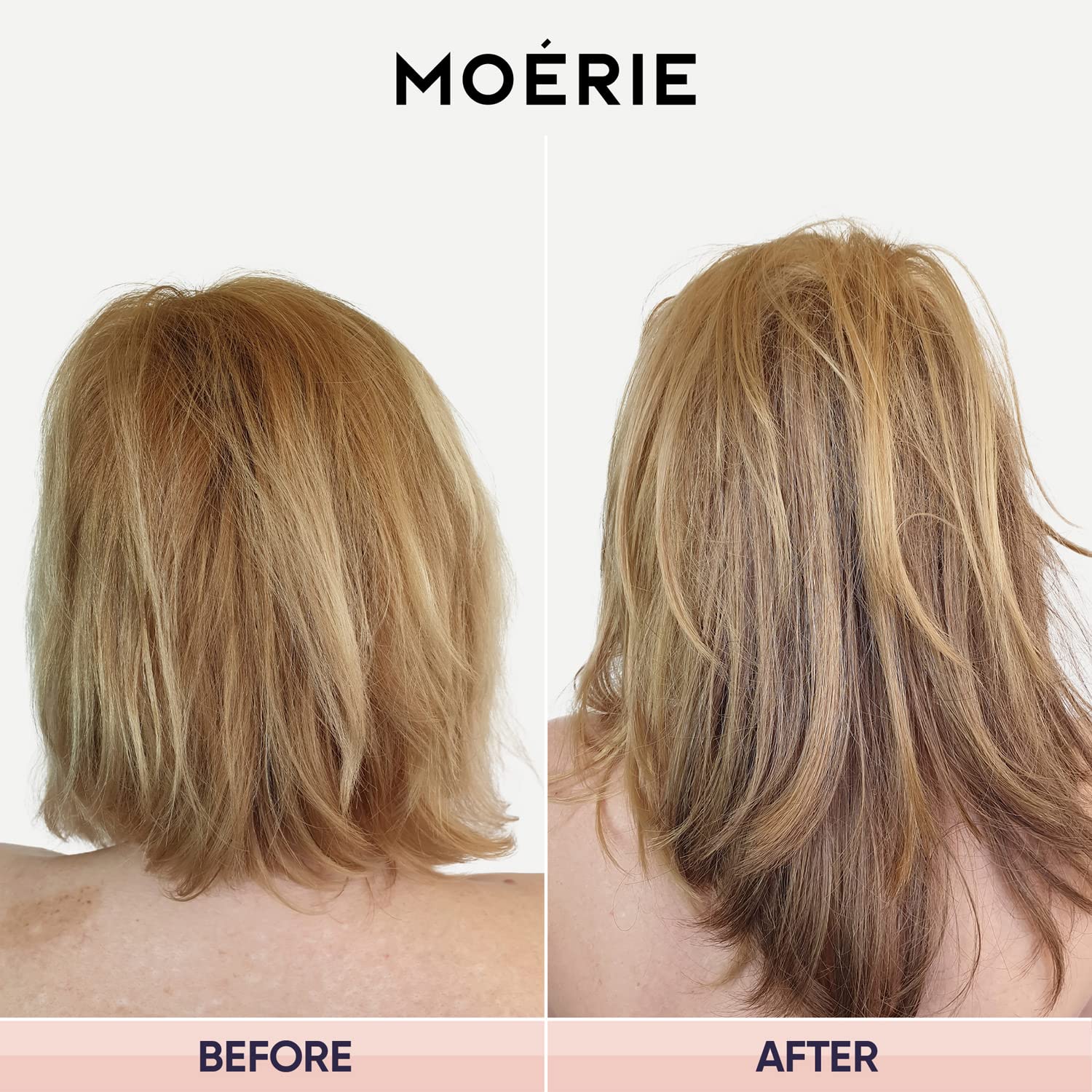 Foto 7 | Spray Para El Crecimiento Del Cabello M Moérie Ultimate Strengthence 150 Ml - Venta Internacional.