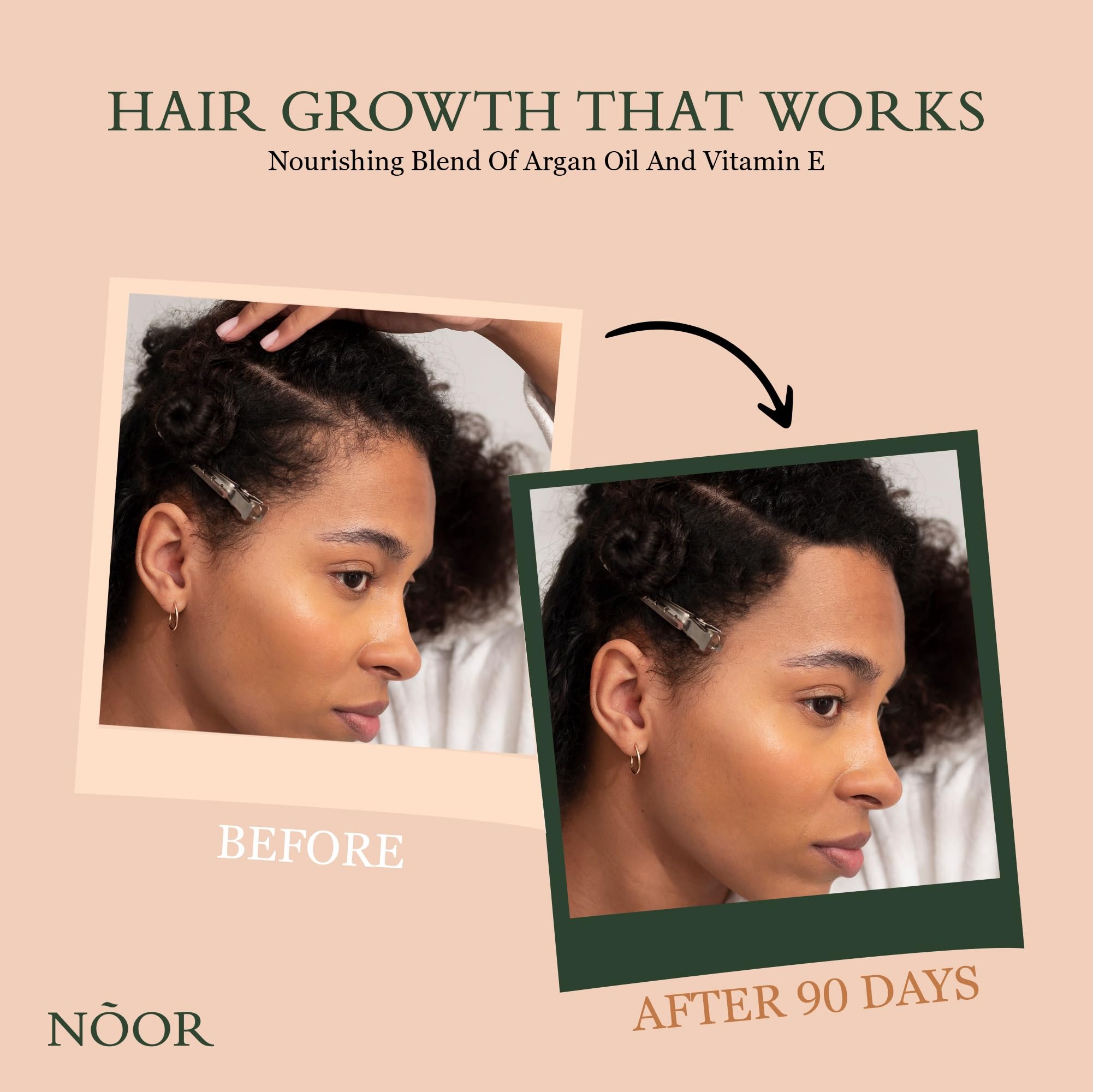 Foto 4 pulgar | Sérum Para El Crecimiento Del Cabello Noor Hair Para Mujeres Con Aceite De Oliva Africano - Venta Internacional.