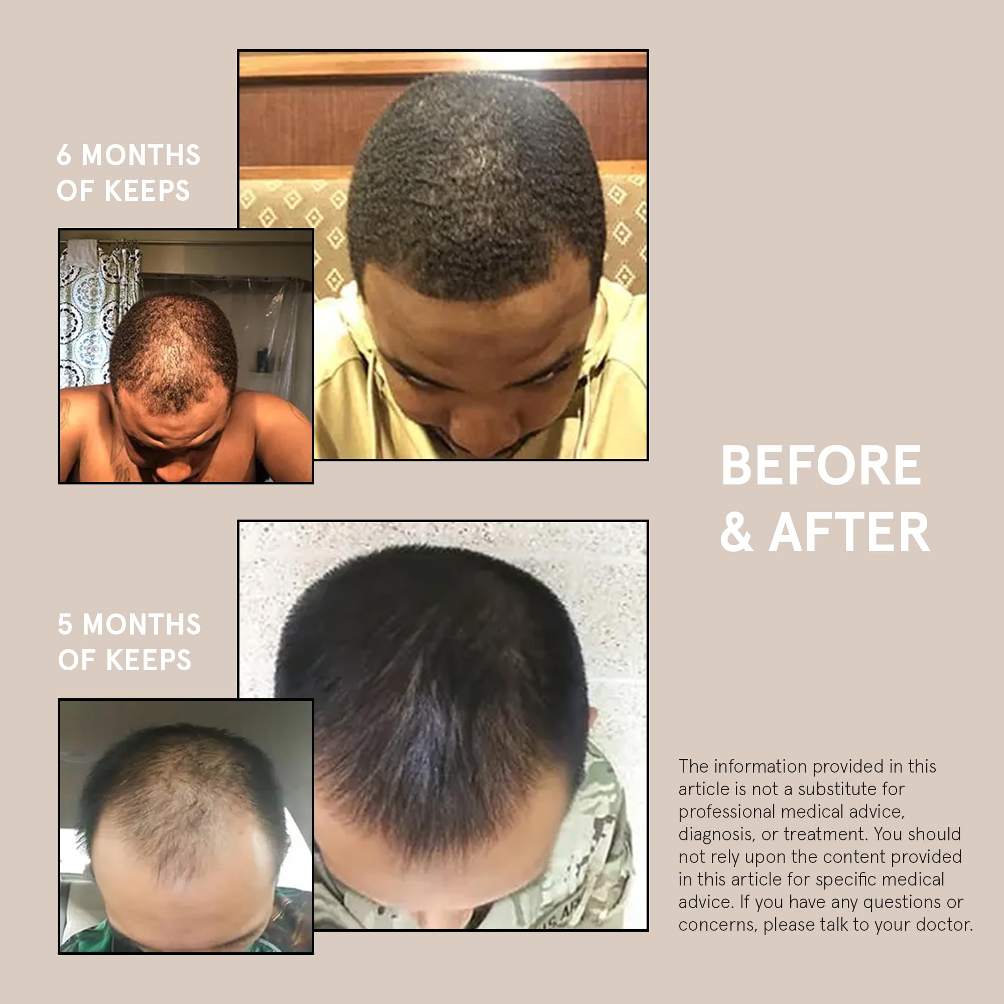Foto 6 pulgar | El Sérum Para El Crecimiento Del Cabello Mantiene El Minoxidil 5% Extra Fuerte Para Hombres - Venta Internacional.
