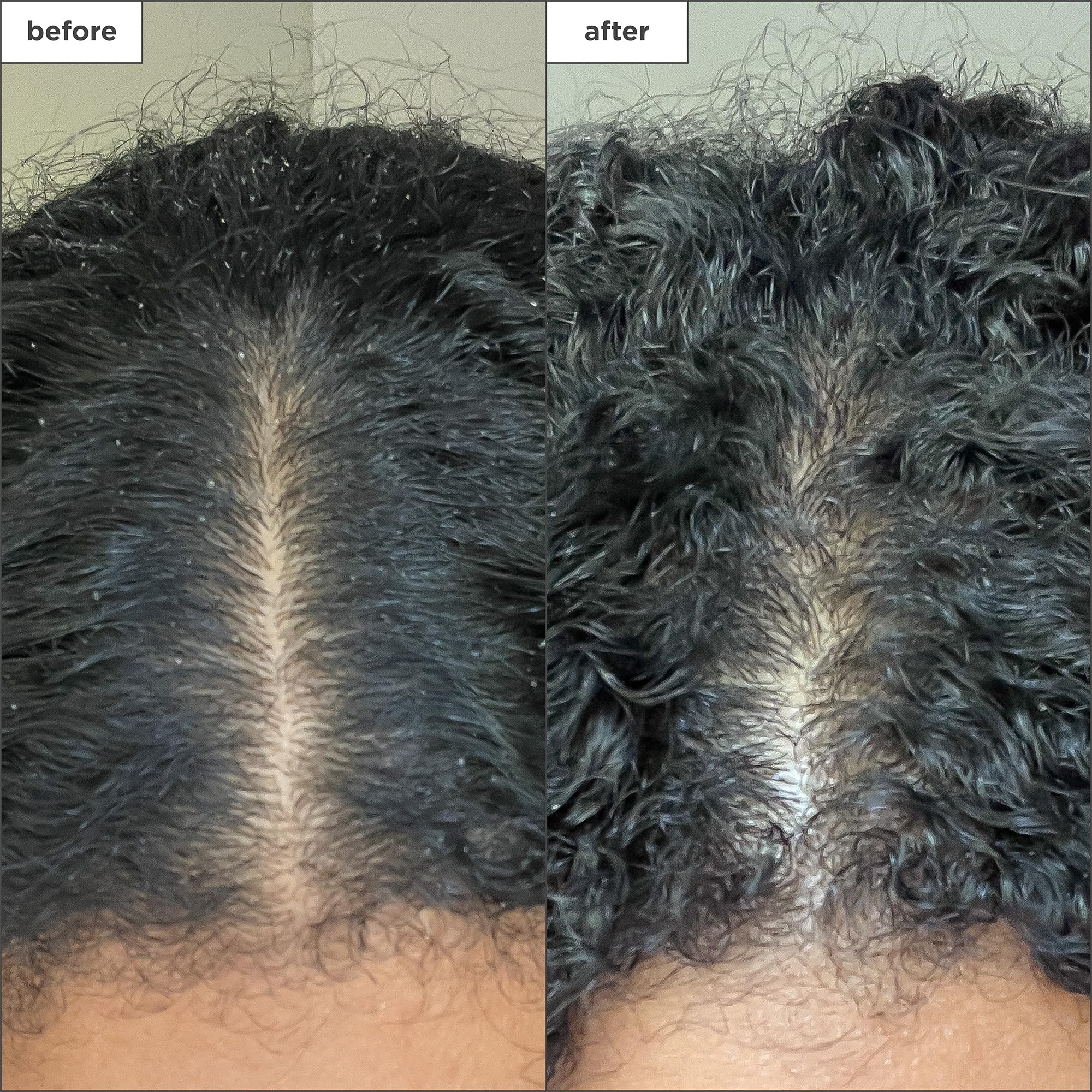 Foto 8 pulgar | Champú Briogeo Scalp Revival, Exfoliante, Carbón Vegetal, 240 Ml - Venta Internacional.