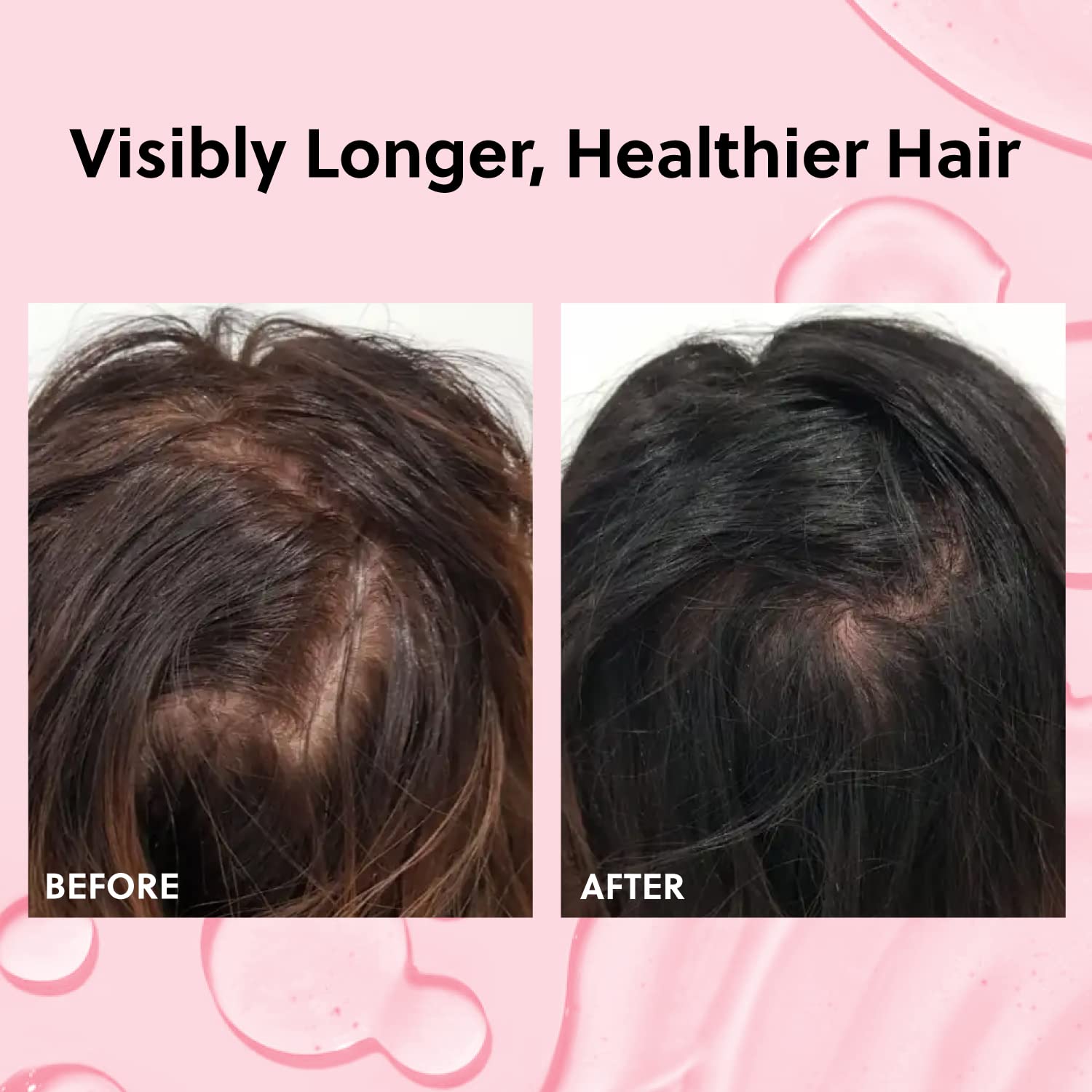 Foto 2 | Aceite En Aerosol Para El Crecimiento Del Cabello De Forchics, No Grasoso, 60 Ml - Venta Internacional.