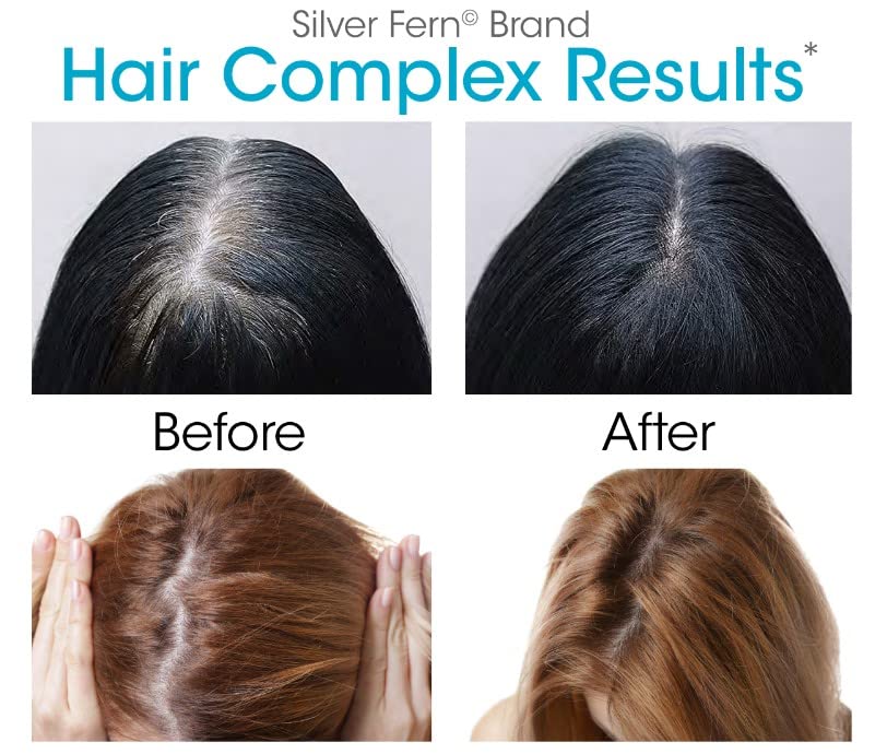 Foto 6 | Suplemento Capilar Silver Fern Hair Complex 30 Cápsulas - Venta Internacional.
