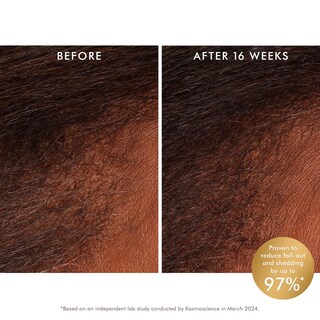 Foto 2 | Tratamiento Tónico Para El Cuero Cabelludo Moroccanoil Que Revitaliza El Cabello Fino - Venta Internacional.