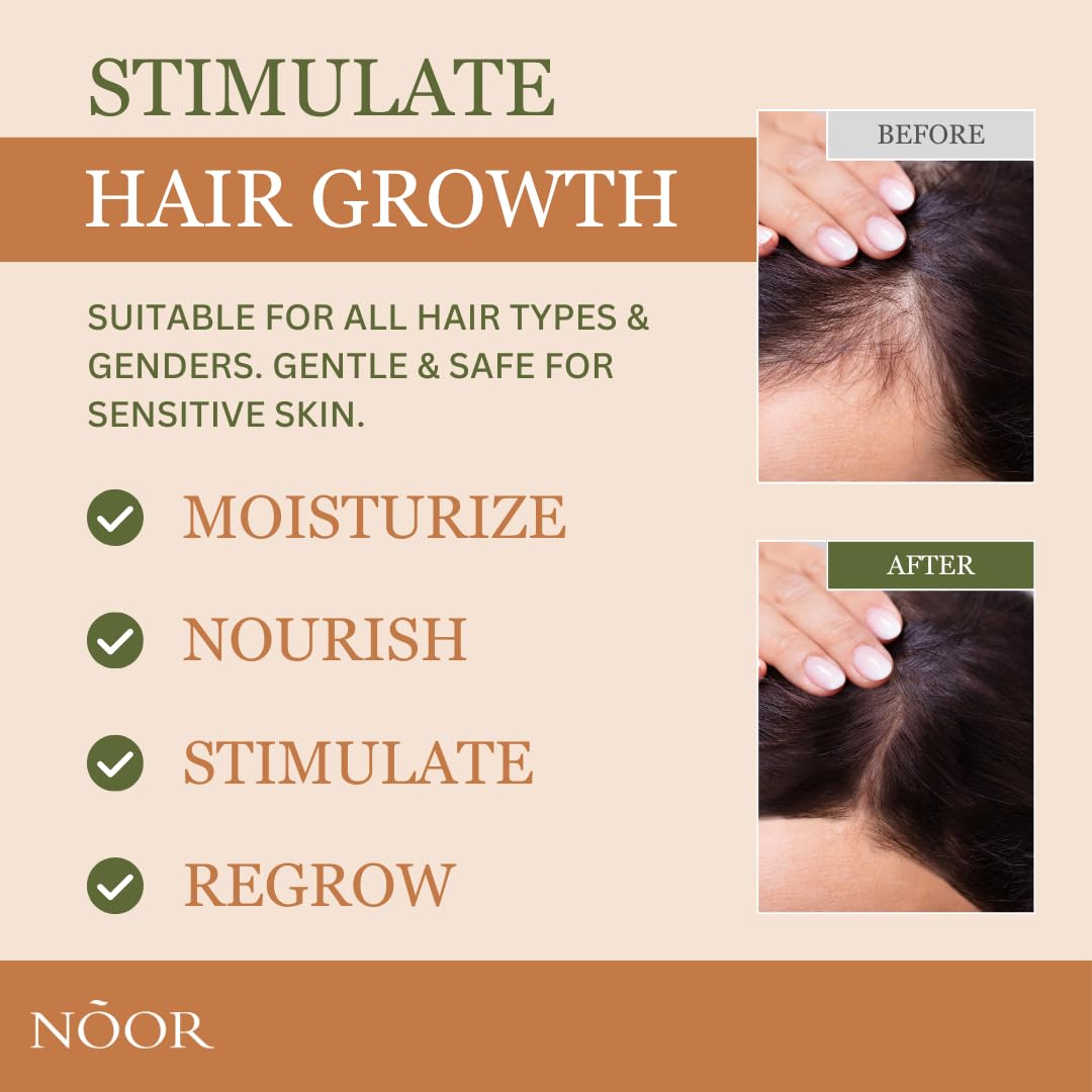 Foto 4 pulgar | Spray Para El Crecimiento Del Cabello Noor Wonder Para Mujer 9 En 1 Superboost - Venta Internacional.