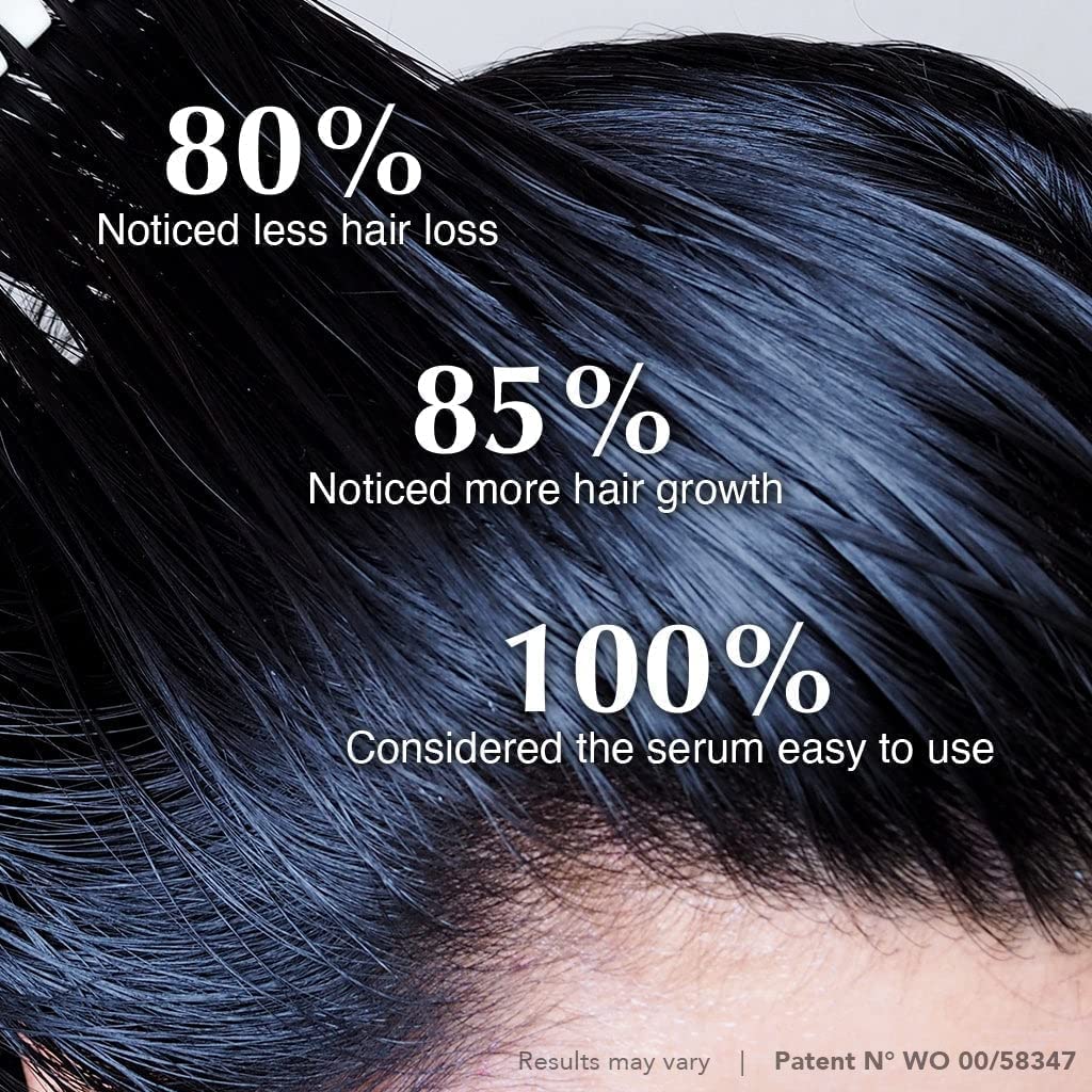 Foto 5 pulgar | Sérum Para Cuero Cabelludo Hairtamin, Tratamiento Natural Para El Crecimiento Del Cabello - Venta Internacional.