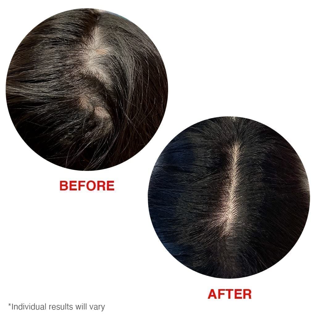 Foto 7 pulgar | Sérum Para Cuero Cabelludo Hairtamin, Tratamiento Natural Para El Crecimiento Del Cabello - Venta Internacional.