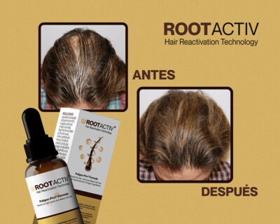 Foto 5 | Loción Para La Caída Del Cabello Con Gotero Rootactiv Capilia Longa + Niacinamida Frasco Con 50 Ml 6 Pack.