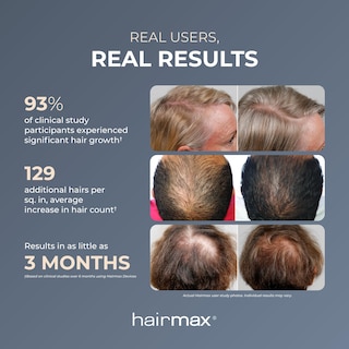 Foto 3 | Dispositivo Para El Crecimiento Del Cabello Hairmax Laser Band 41 Aprobado Por La Fda - Venta Internacional.
