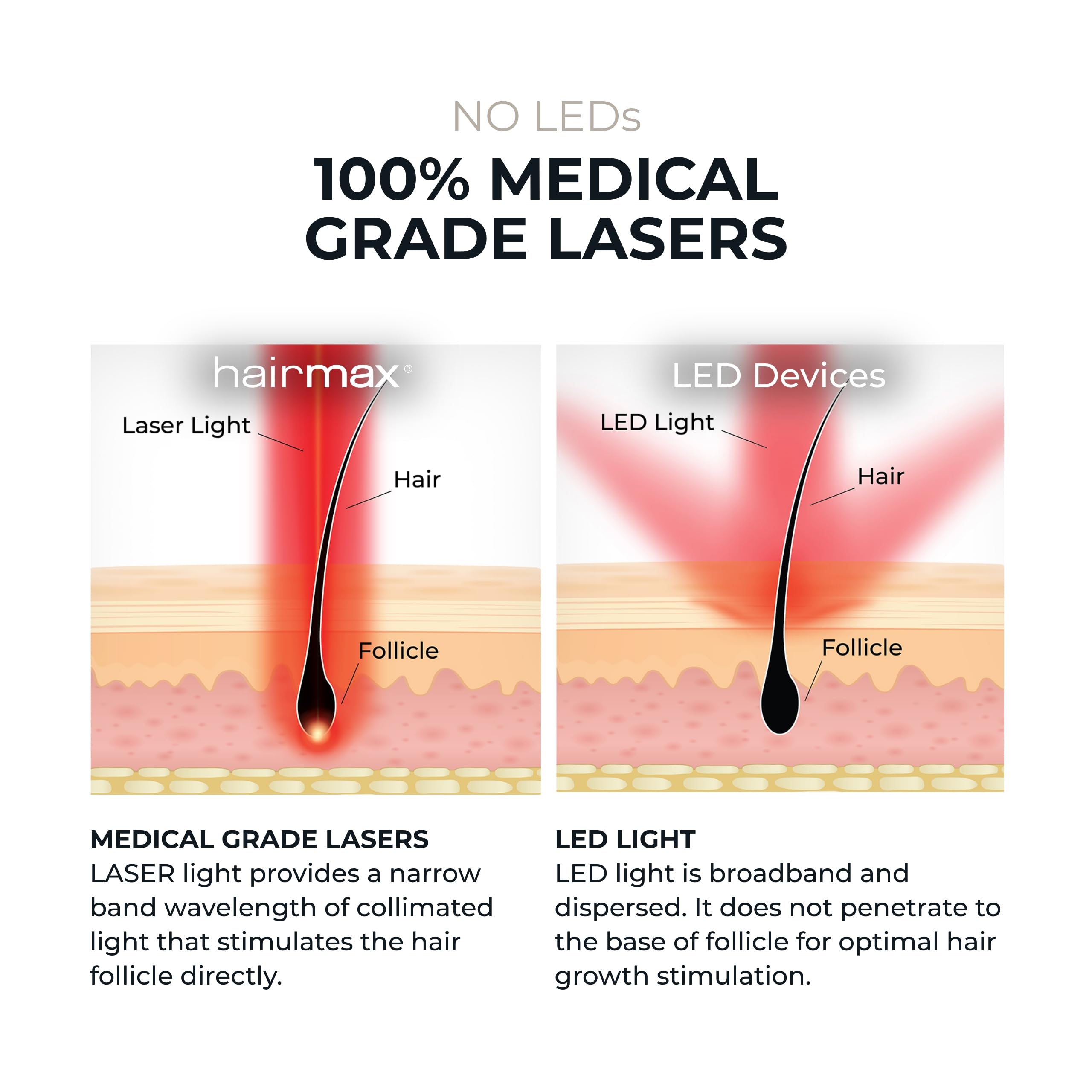 Foto 6 | Dispositivo Para El Crecimiento Del Cabello Hairmax Laser Band 41 Aprobado Por La Fda - Venta Internacional.