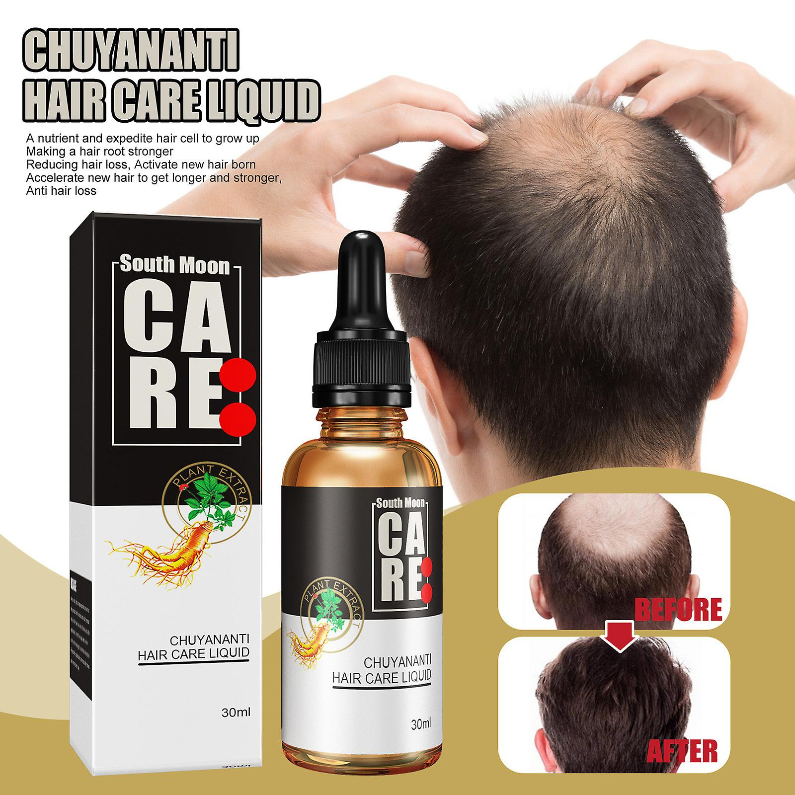 Foto 4 pulgar | Aceite Esencial Para El Crecimiento Del Cabello Huoguo  30 Ml  Nutre El Cuero Cabelludo - Venta Internacional.
