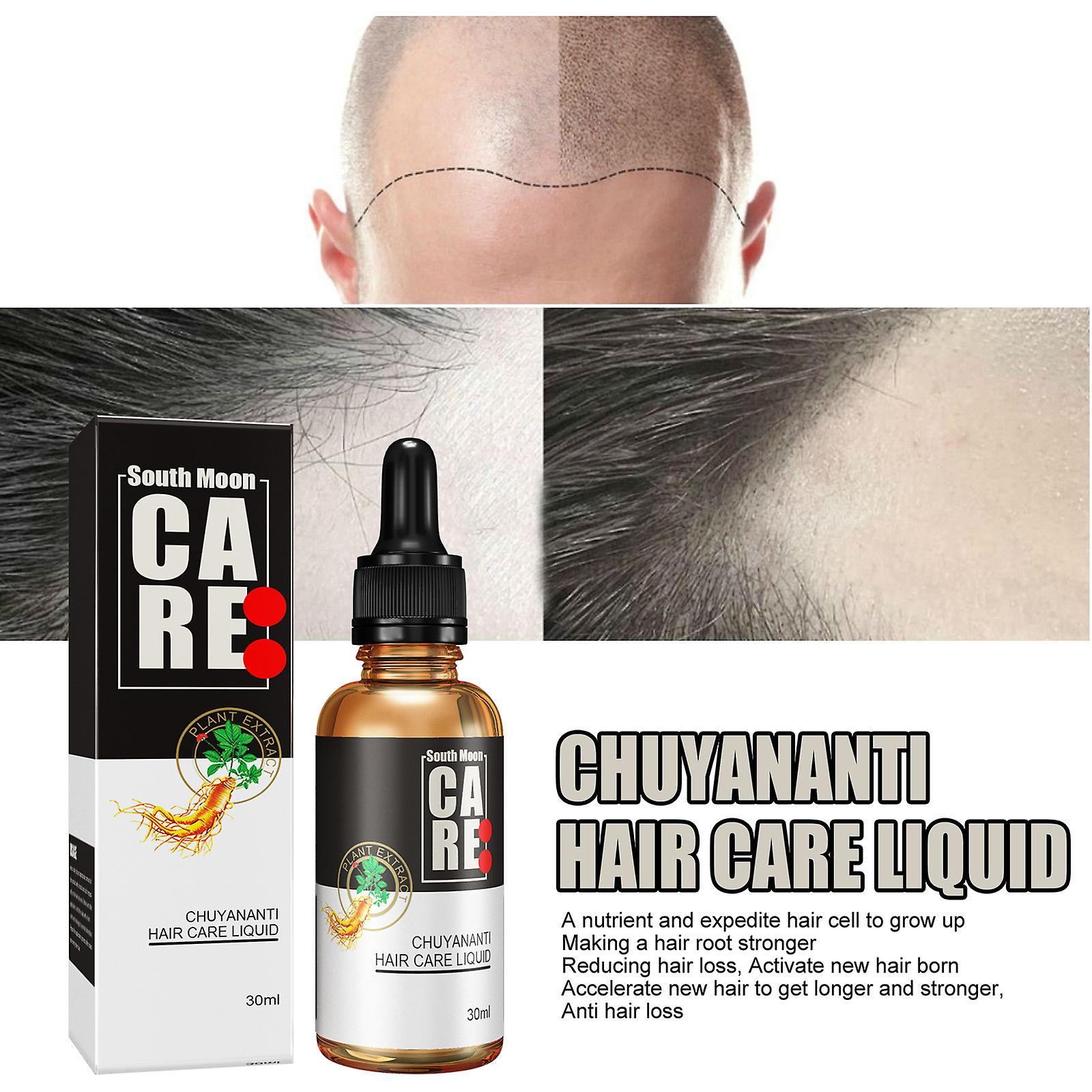 Foto 5 pulgar | Aceite Esencial Para El Crecimiento Del Cabello Huoguo  30 Ml  Nutre El Cuero Cabelludo - Venta Internacional.
