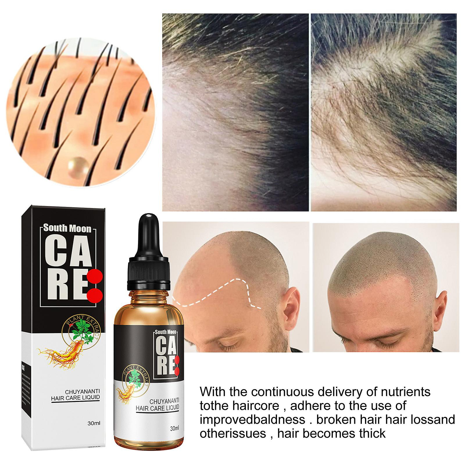Foto 6 pulgar | Aceite Esencial Para El Crecimiento Del Cabello Huoguo  30 Ml  Nutre El Cuero Cabelludo - Venta Internacional.