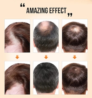 Foto 4 | Aceite De Cuidado Capilar Anticaída Hair Repair Essence 35 Ml - Venta Internacional.