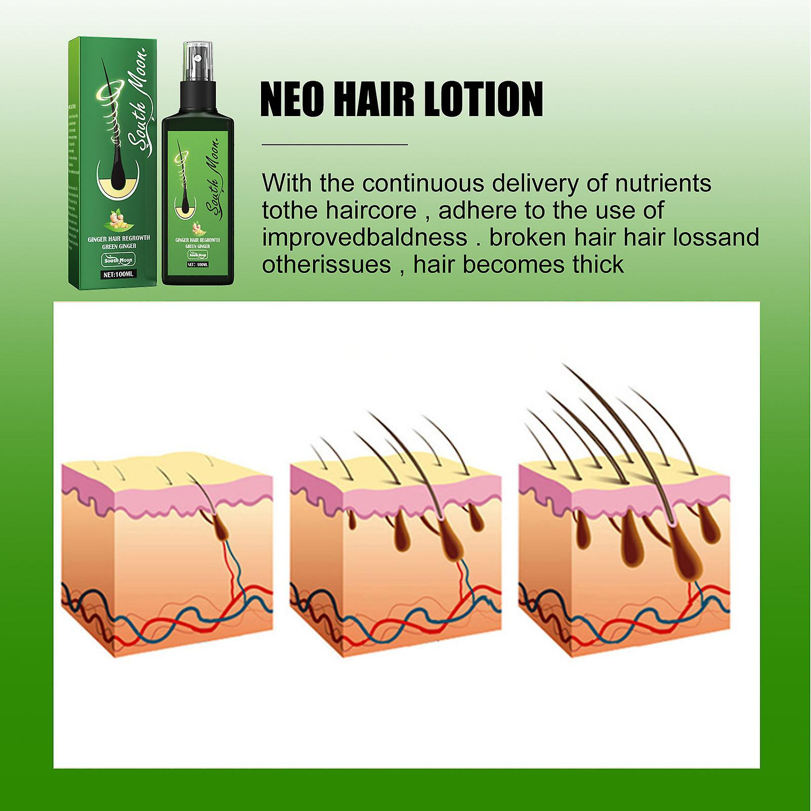 Foto 5 | Sérum En Aerosol Para Pérdida De Cabello  Adelgazamiento Y Crecimiento Del Cabello  100 Ml X 2 - Venta Internacional.