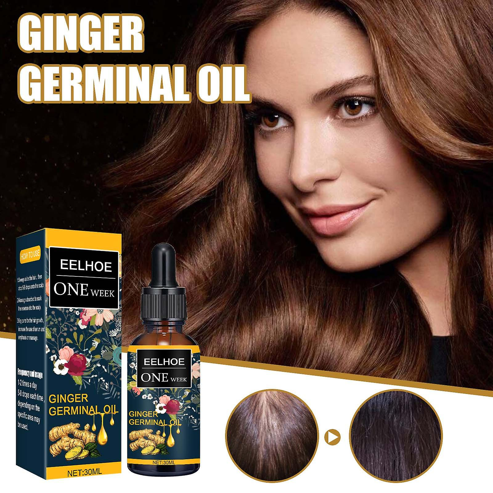 Foto 3 pulgar | Aceite Esencial Para El Crecimiento Del Cabello Huoguo  Jengibre  Nutre El Cuero Cabelludo  30 Ml - Venta Internacional.