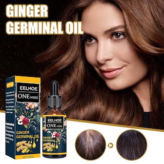 Foto 2 | Aceite Esencial Para El Crecimiento Del Cabello Huoguo Jengibre Nutre El Cuero Cabelludo 30 Ml - Venta Internacional.