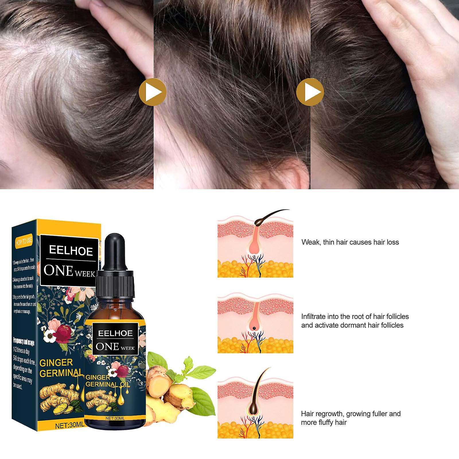 Foto 5 pulgar | Aceite Esencial Para El Crecimiento Del Cabello Huoguo  Jengibre  Nutre El Cuero Cabelludo  30 Ml - Venta Internacional.