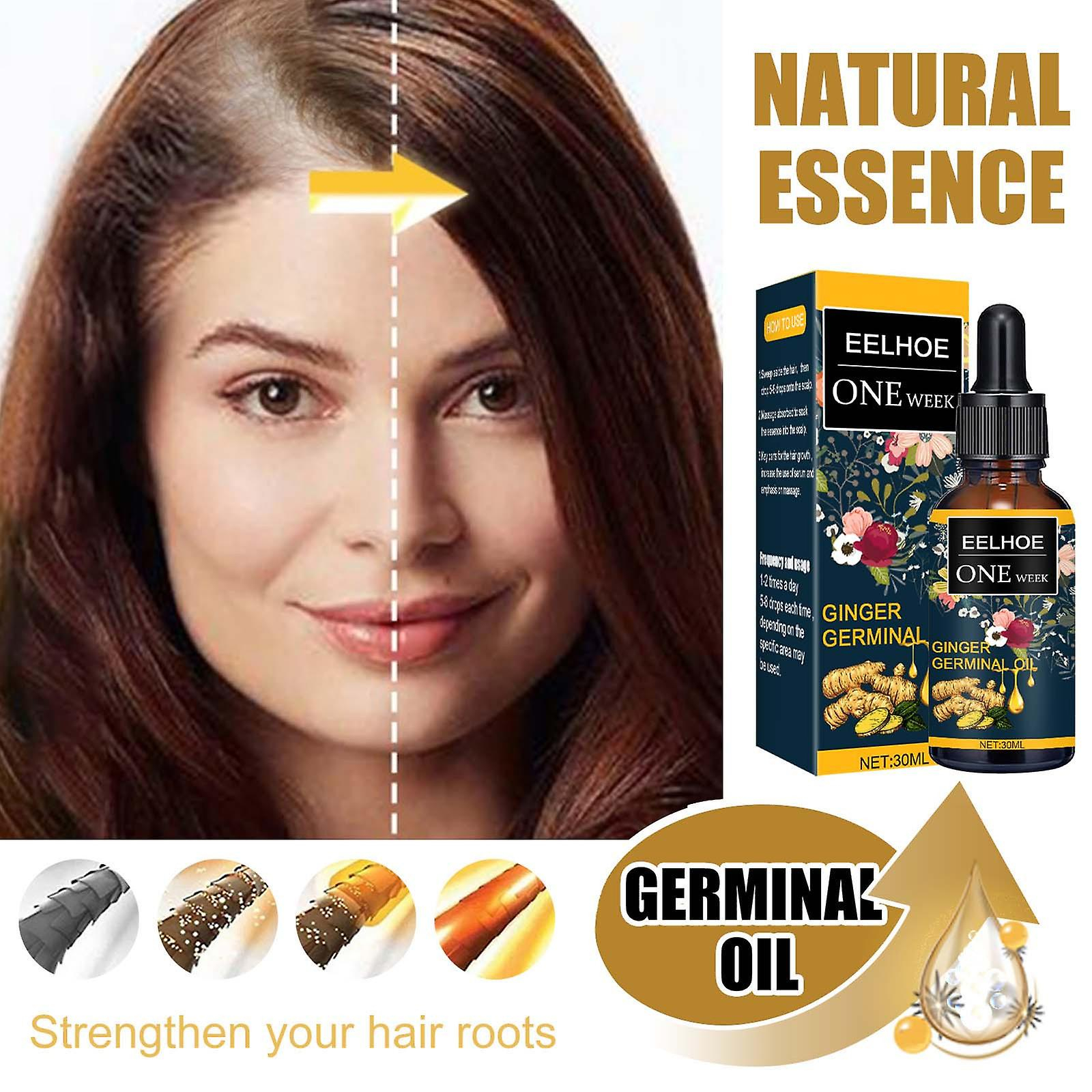 Foto 6 pulgar | Aceite Esencial Para El Crecimiento Del Cabello Huoguo  Jengibre  Nutre El Cuero Cabelludo  30 Ml - Venta Internacional.