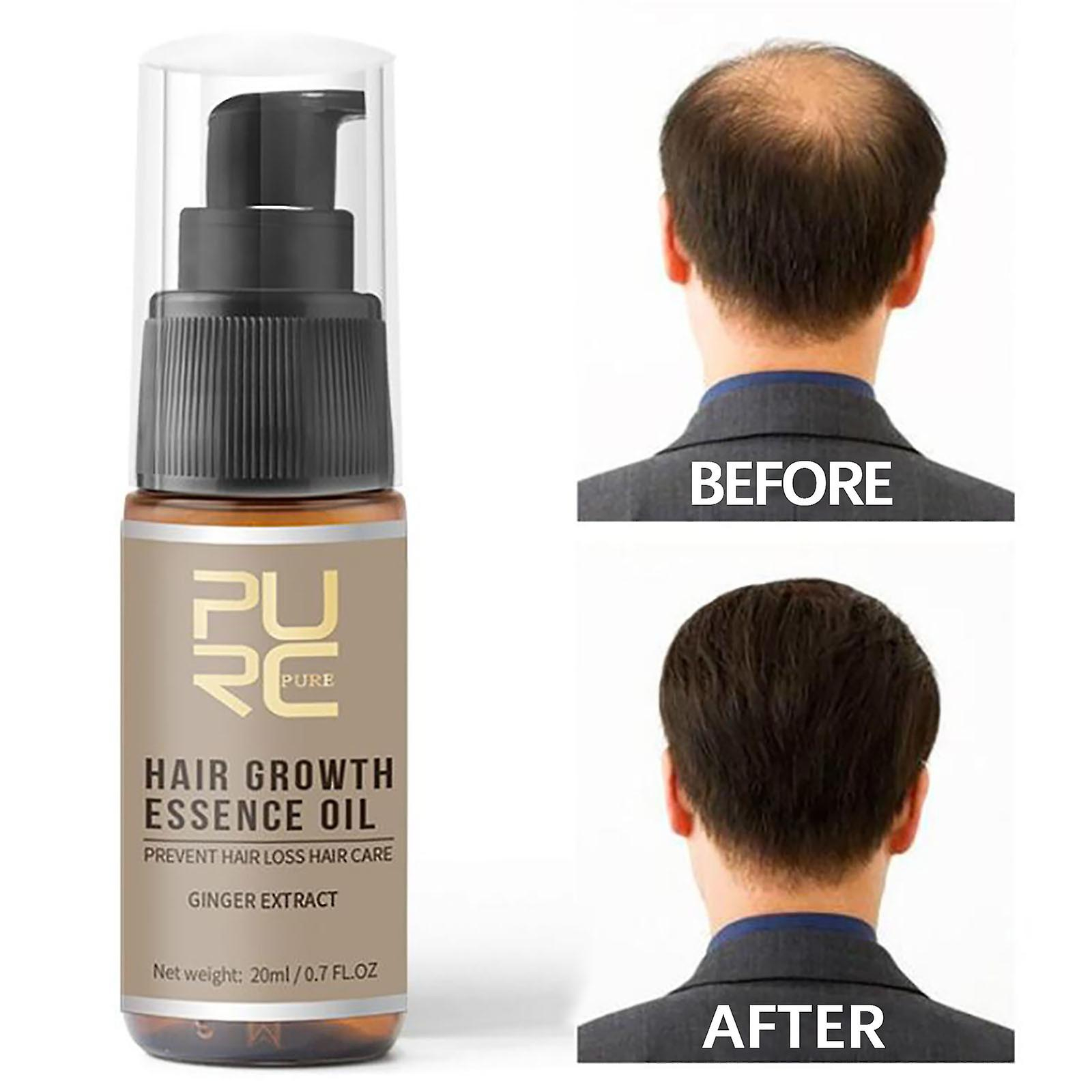 Foto 5 pulgar | Spray Para El Crecimiento Del Cabello Huoguo  Extracto De Jengibre  20 Ml  Cuidado Del Cuero Cabellu - Venta Internac