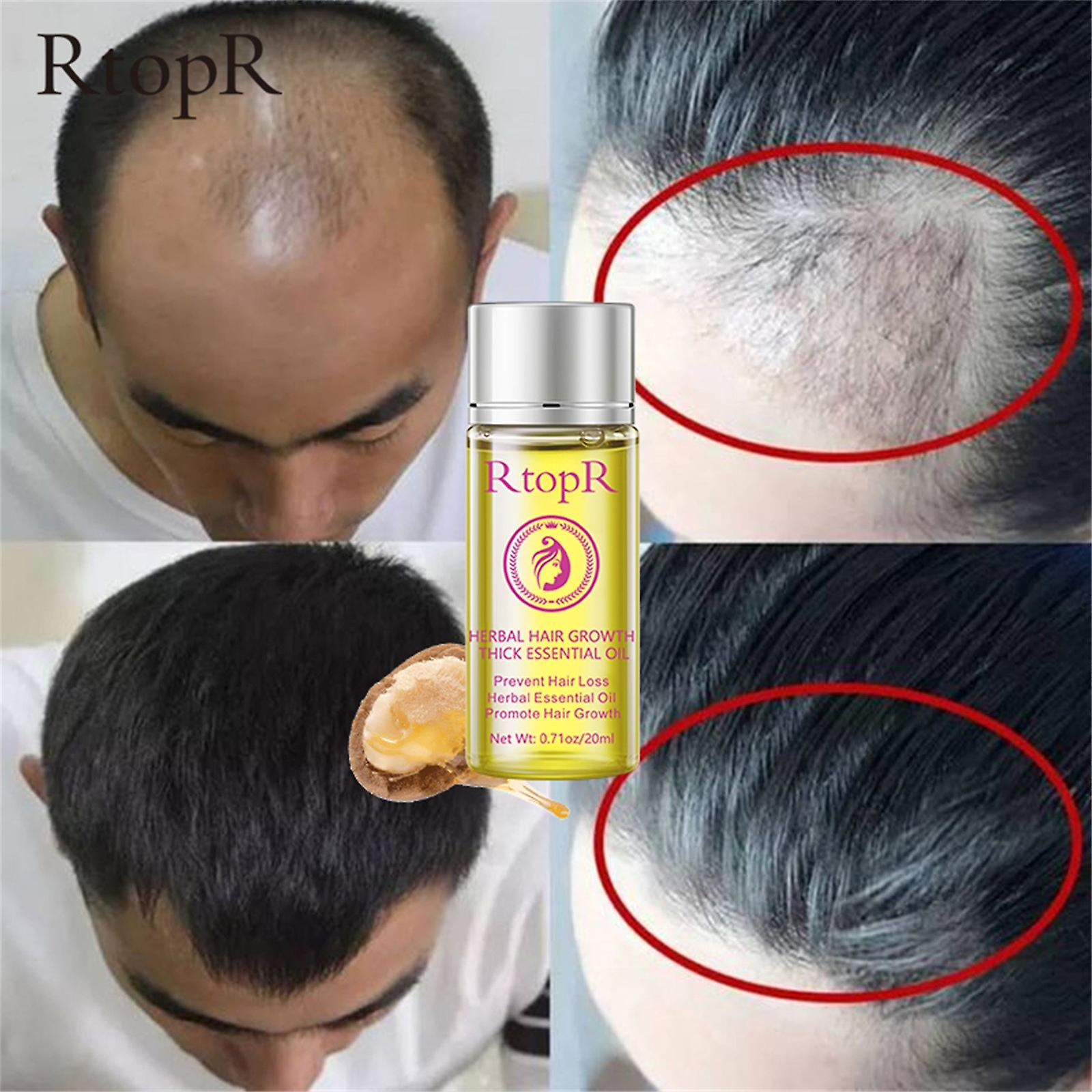 Foto 6 pulgar | Aceite Esencial Para El Crecimiento Del Cabello  Reparador Y Cuidado Del Cabello  20 Ml - Venta Internacional.