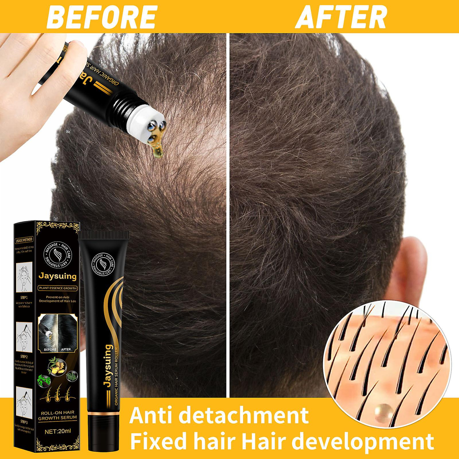 Foto 5 pulgar | Crema Para El Cuidado Del Folículo Piloso  Sérum Orgánico Regenerador  20 Ml - Venta Internacional.