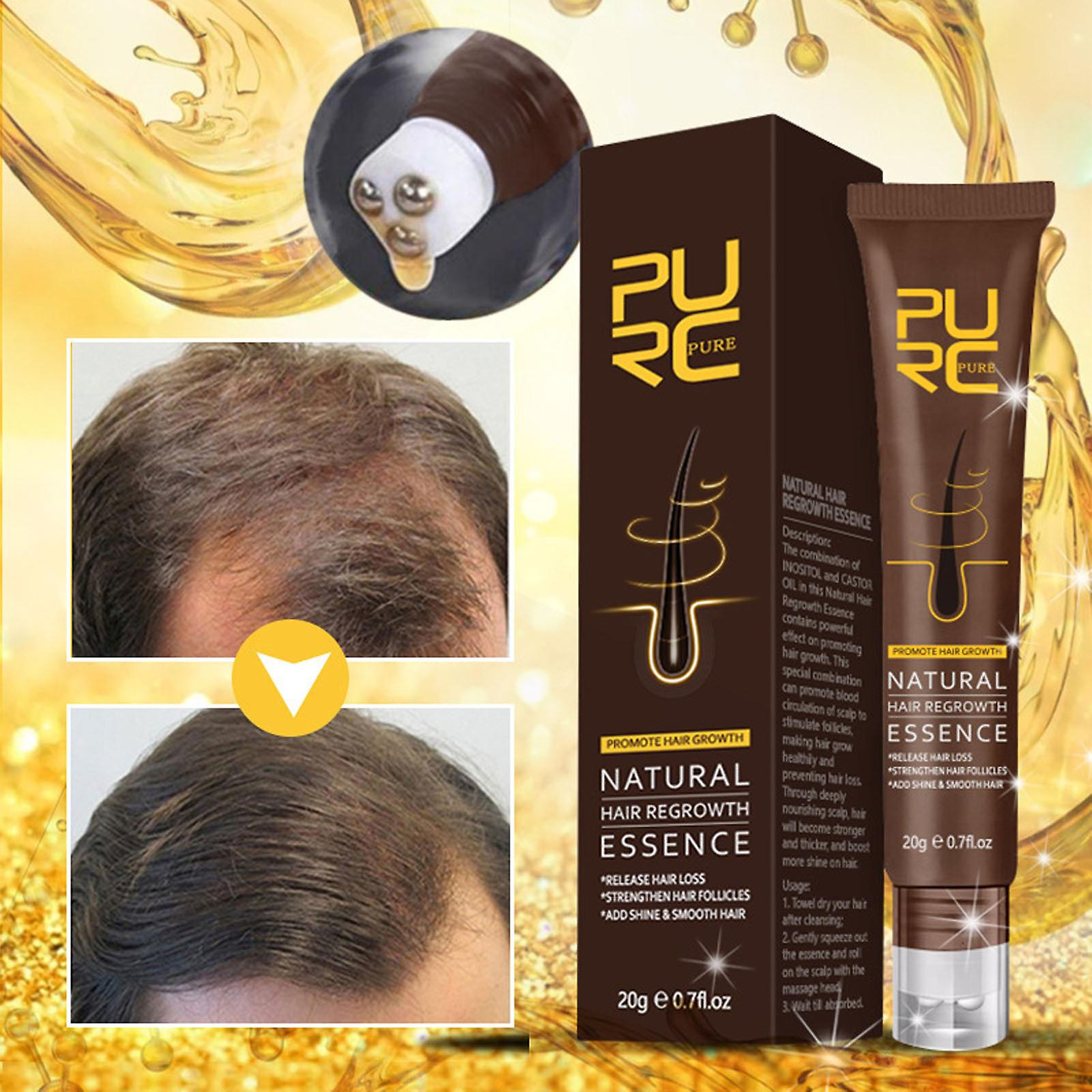 Foto 2 | Loción Capilar Para Prevenir La Caída Del Cabello  20 Ml  Para Un Crecimiento De Cabello Denso - Venta Internacional.