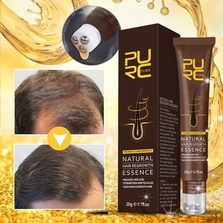 Foto 2 | Loción Capilar Para Prevenir La Caída Del Cabello 20 Ml Para Un Crecimiento De Cabello Denso - Venta Internacional.