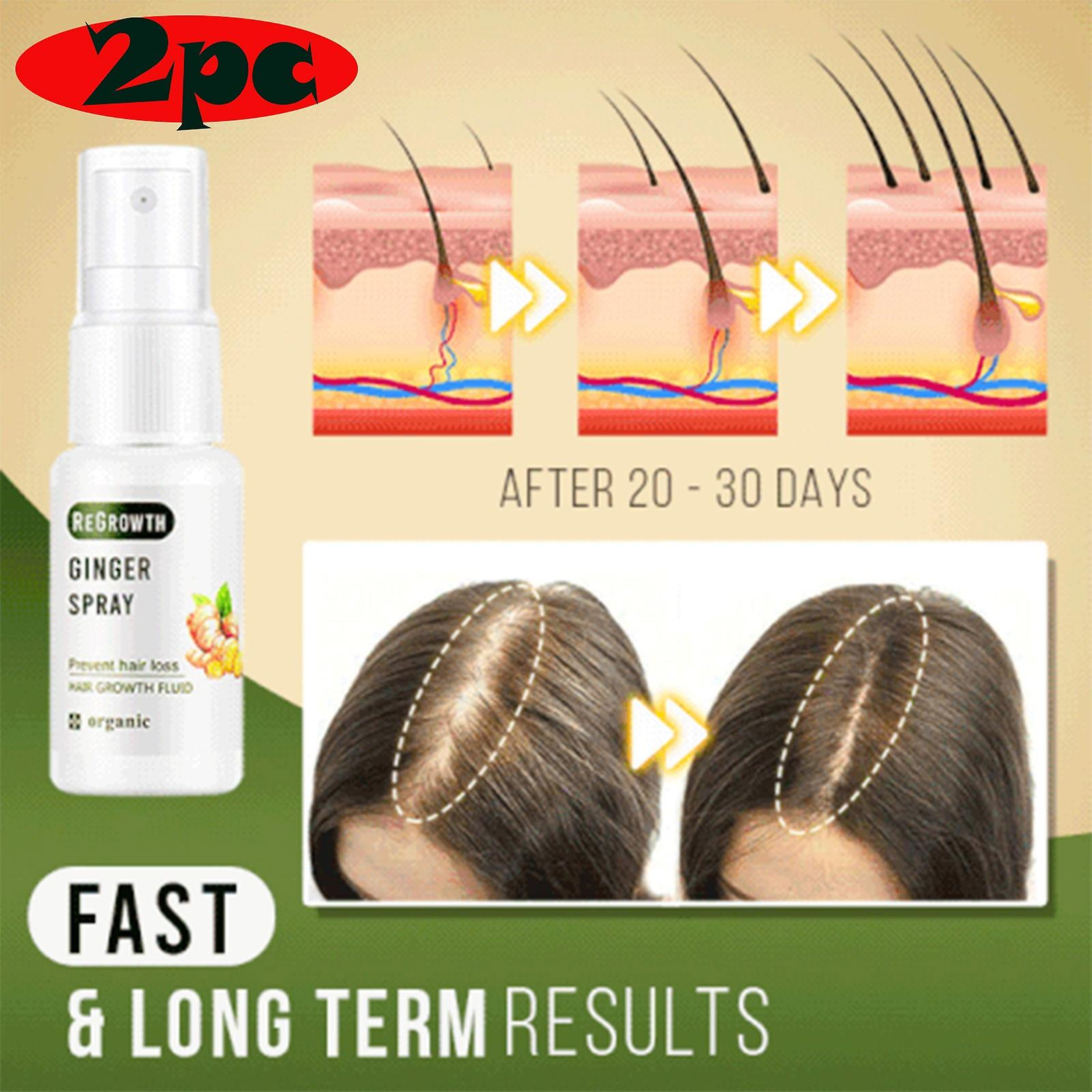 Foto 3 pulgar | Spray Para Tratamiento De Pérdida De Cabello Oriental Oils Recrowth 40 Ml - Venta Internacional.