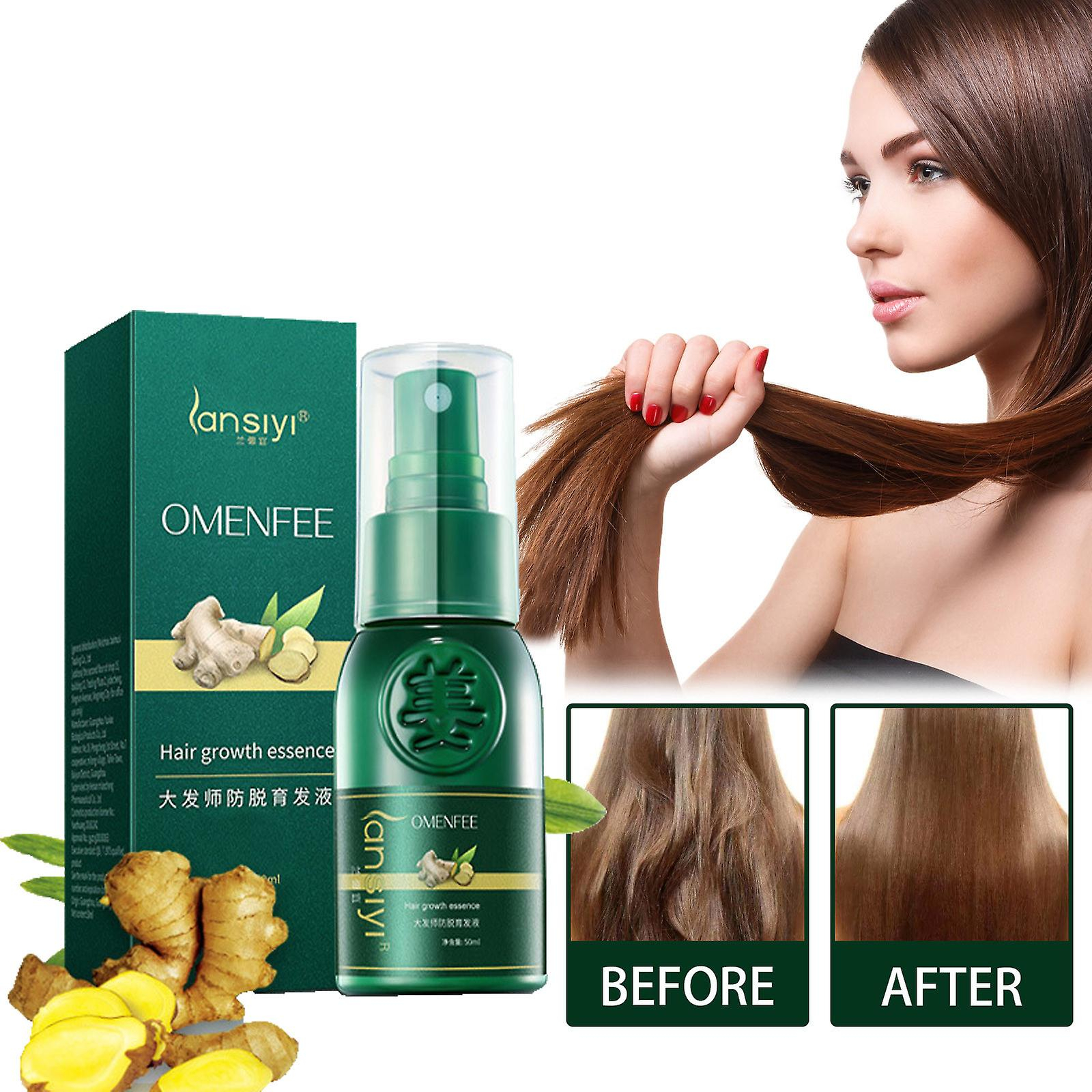 Foto 3 pulgar | Aceite Esencial Para El Crecimiento Del Cabello Huoguo Resurrection 30 Ml - Venta Internacional.