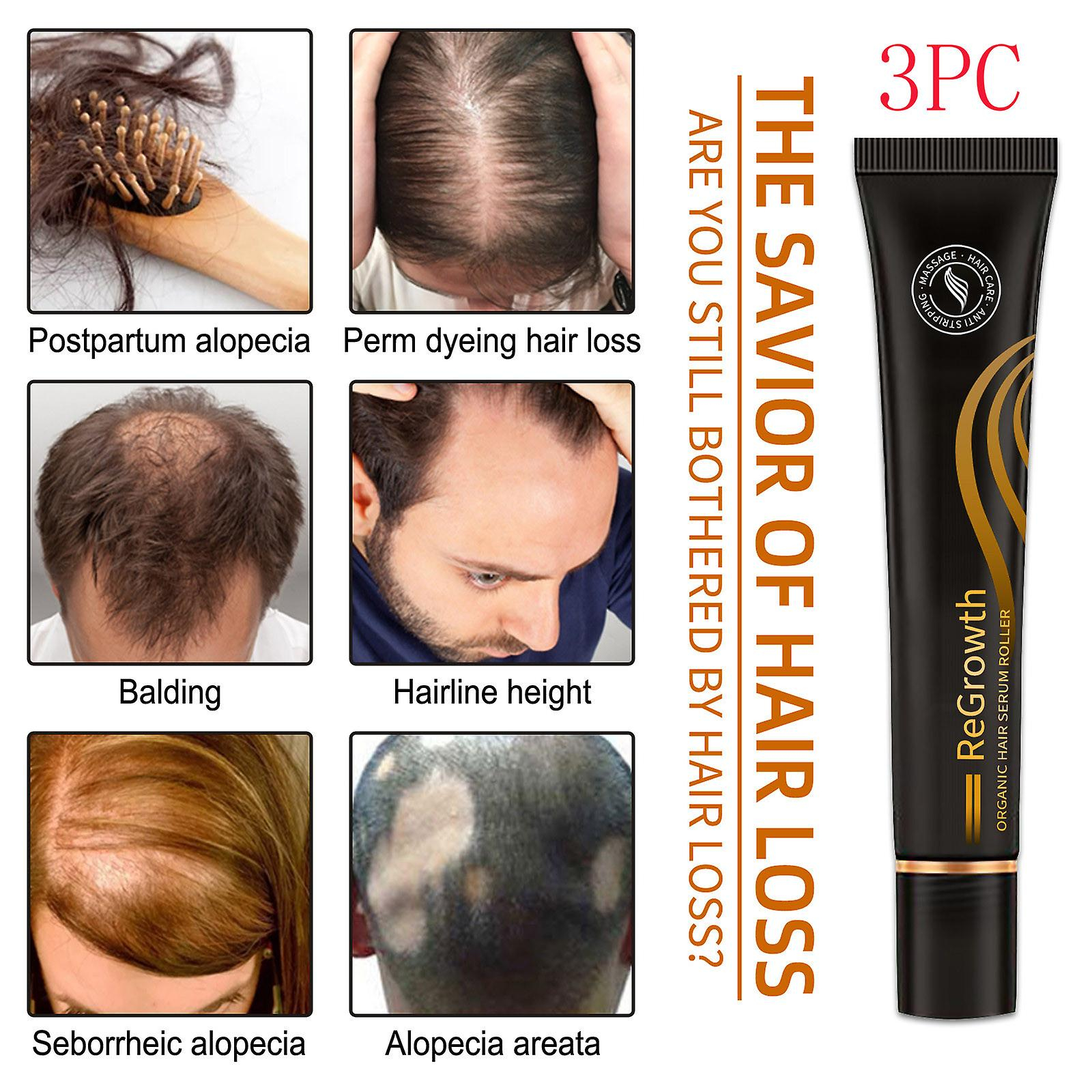 Foto 3 pulgar | Crema Para El Cuidado Del Folículo Piloso Huoguo Previene La Caída Del Cabello  60 Ml - Venta Internacional.