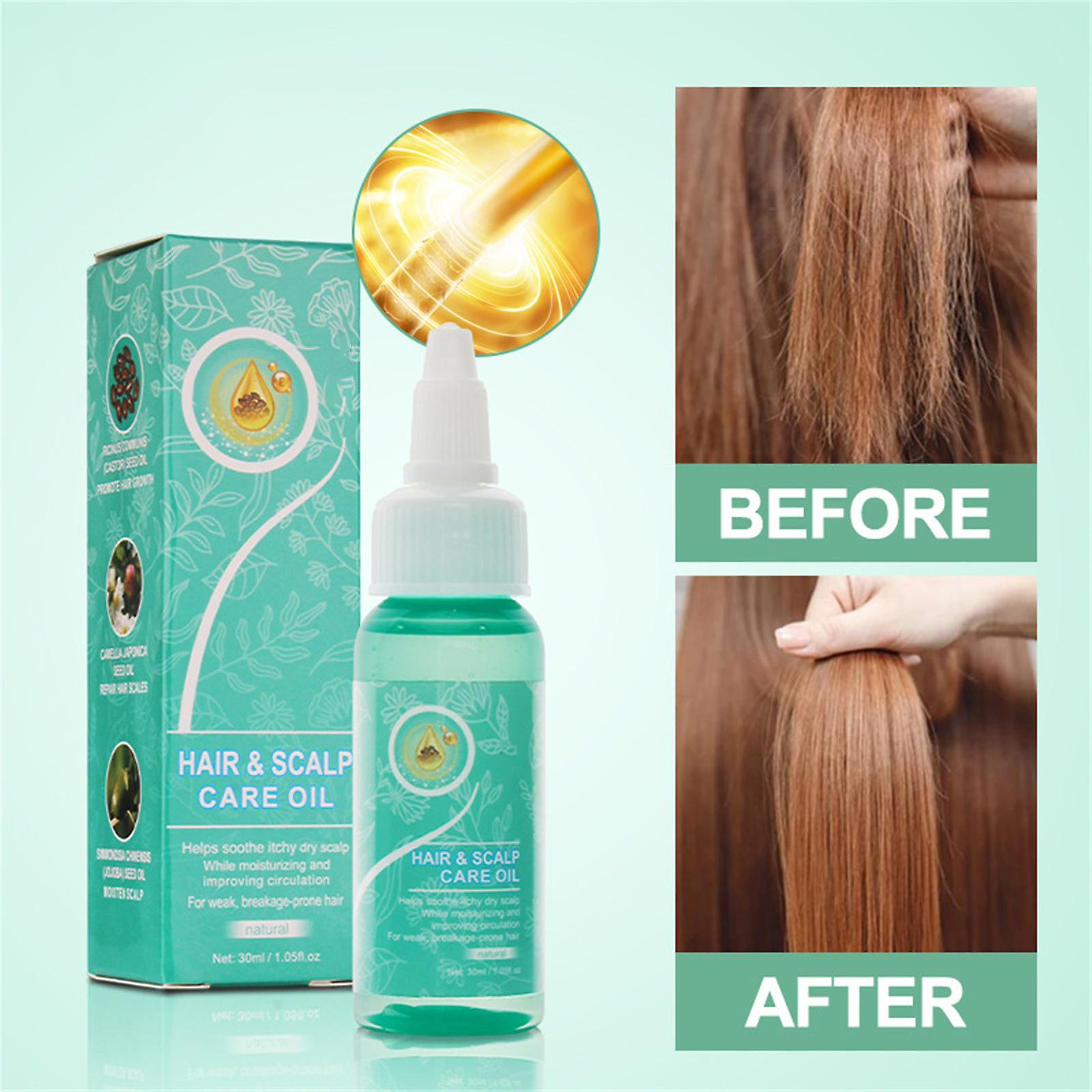 Foto 5 | Tratamiento De Cuero Cabelludo Con Sérum Suma Activador Del Cabello  30 Ml Huoguo - Venta Internacional.