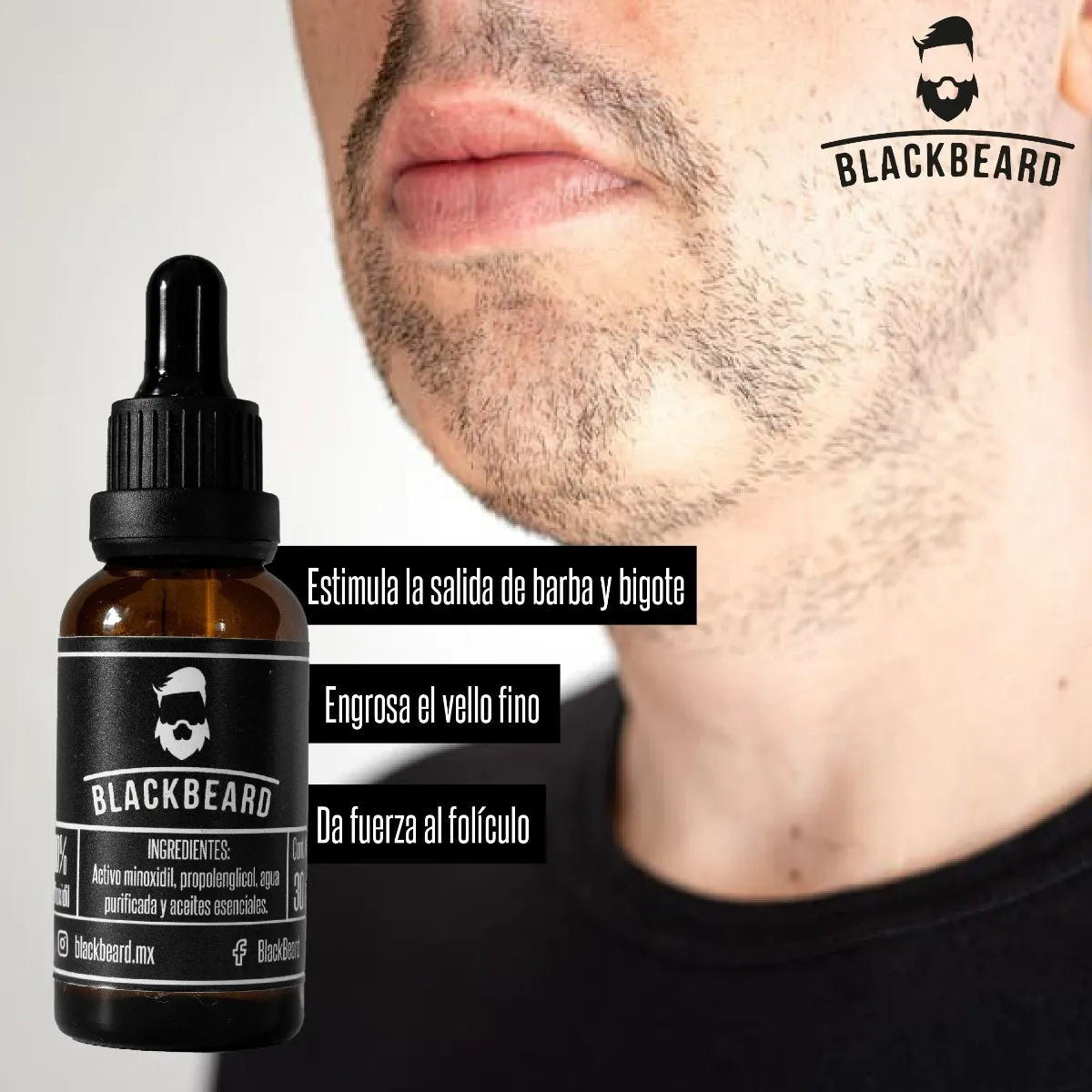 Foto 5 pulgar | Minoxidil 10% Blackbeard Tónico Capilar para Barba y Cabello