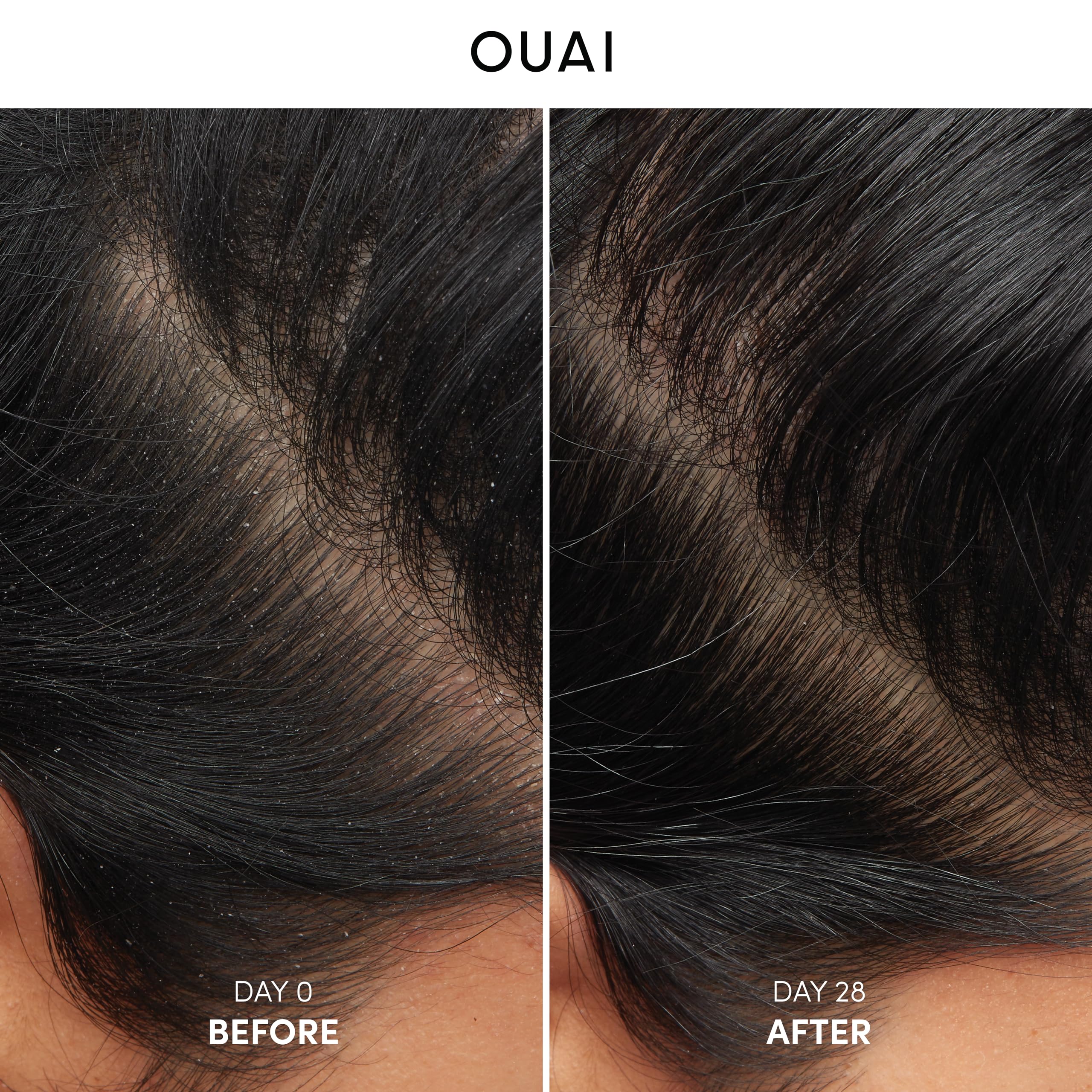 Foto 8 pulgar | Paquete De Champú Ouai Detox (300 Ml) Y Anticaspa (30 Ml) X2 - Venta Internacional.