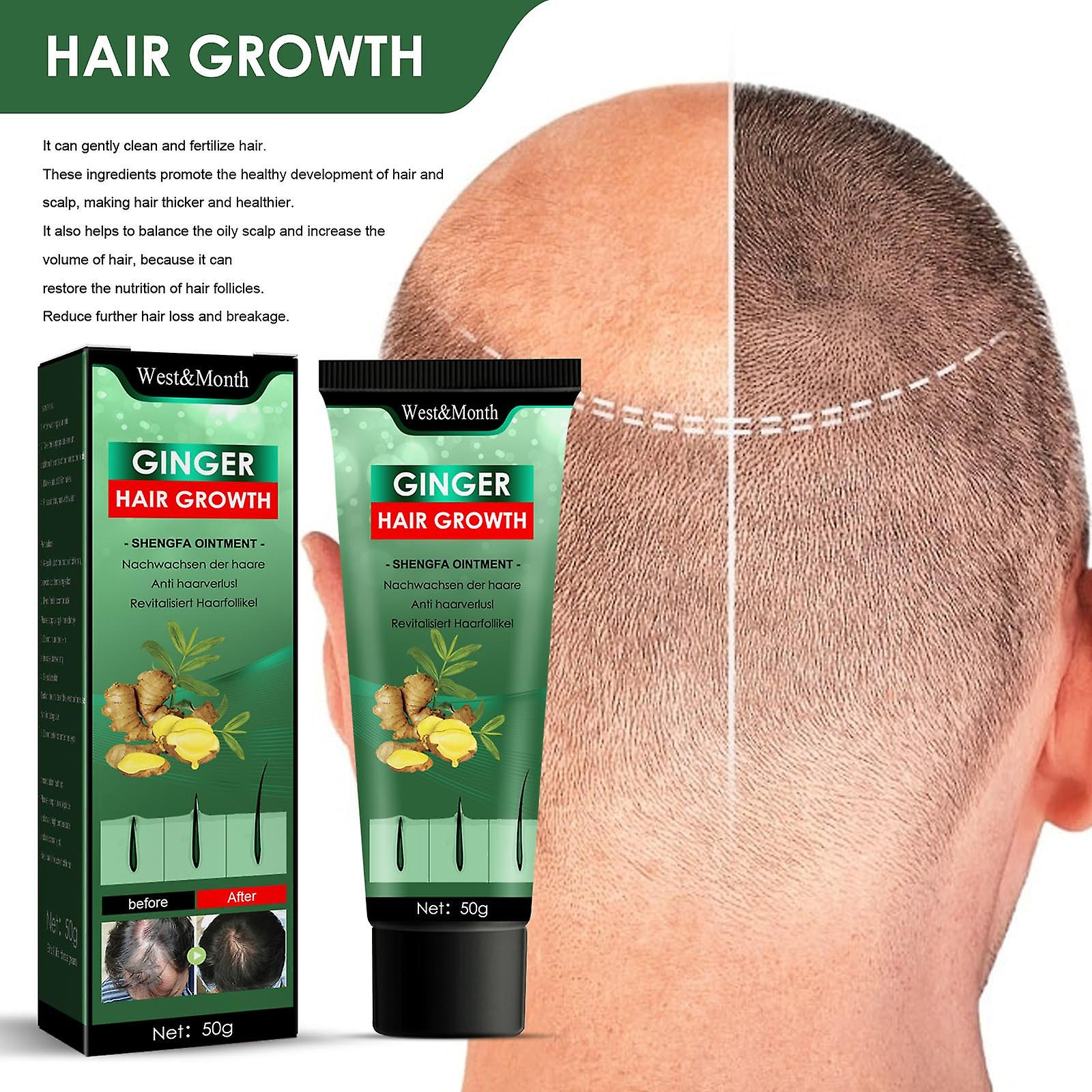 Foto 2 pulgar | Crema Para El Cabello  Masaje Hidratante Del Cuero Cabelludo  Cuidado Del Folículo Piloso - Venta Internacional.