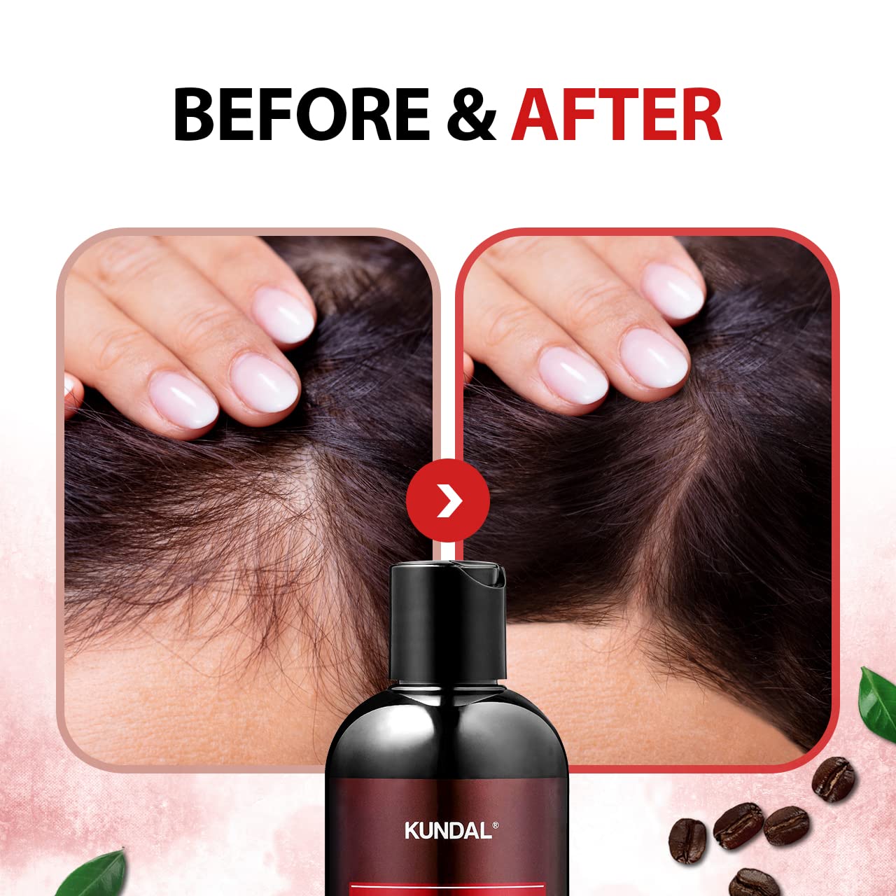 Foto 3 pulgar | Champú Kundal Natural Cafeine Scalp 500 Ml Para Todo Tipo De Cabello - Venta Internacional.