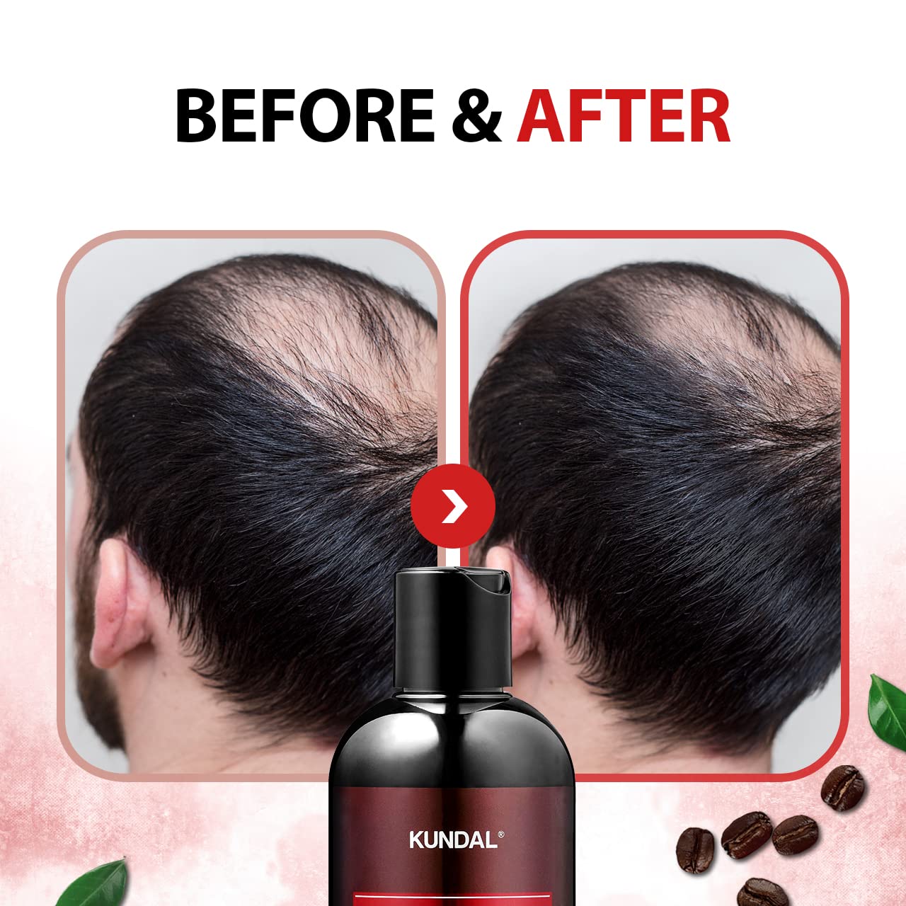 Foto 4 pulgar | Champú Kundal Natural Cafeine Scalp 500 Ml Para Todo Tipo De Cabello - Venta Internacional.