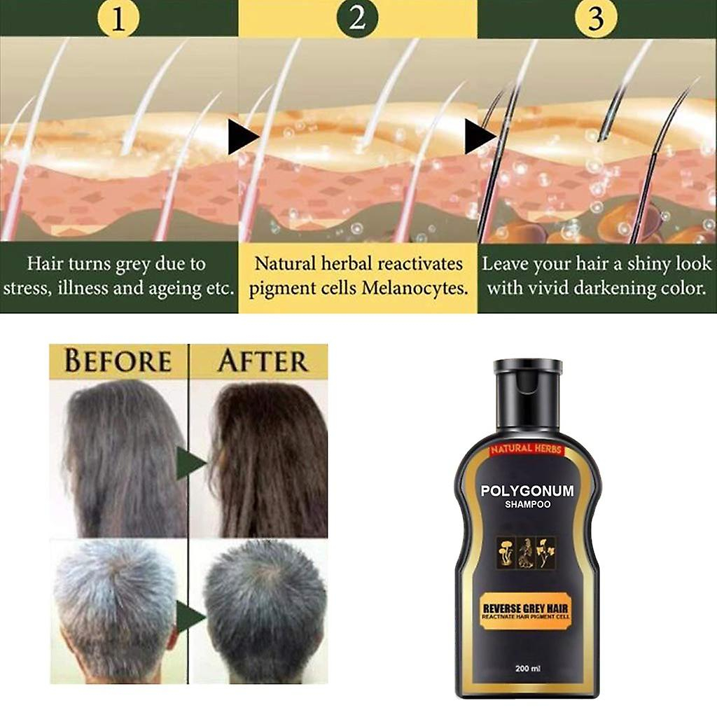 Foto 3 pulgar | Champú Huoguo  Oscurecedor Natural Permanente Para Cabello Negro  200 Ml - Venta Internacional.
